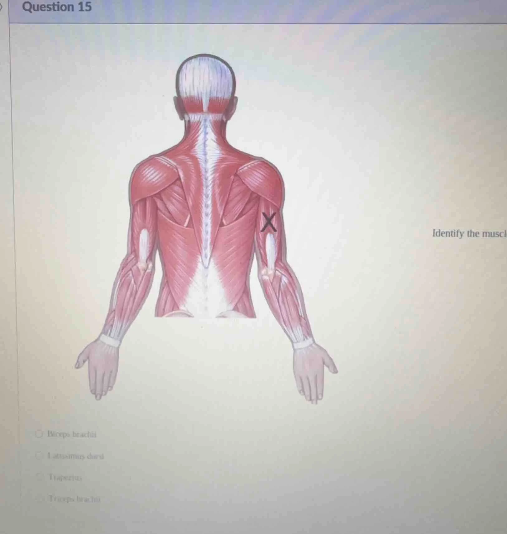 question 15 identify the muscle ○ biceps brachii ○ latissimus dorsi ○ t…