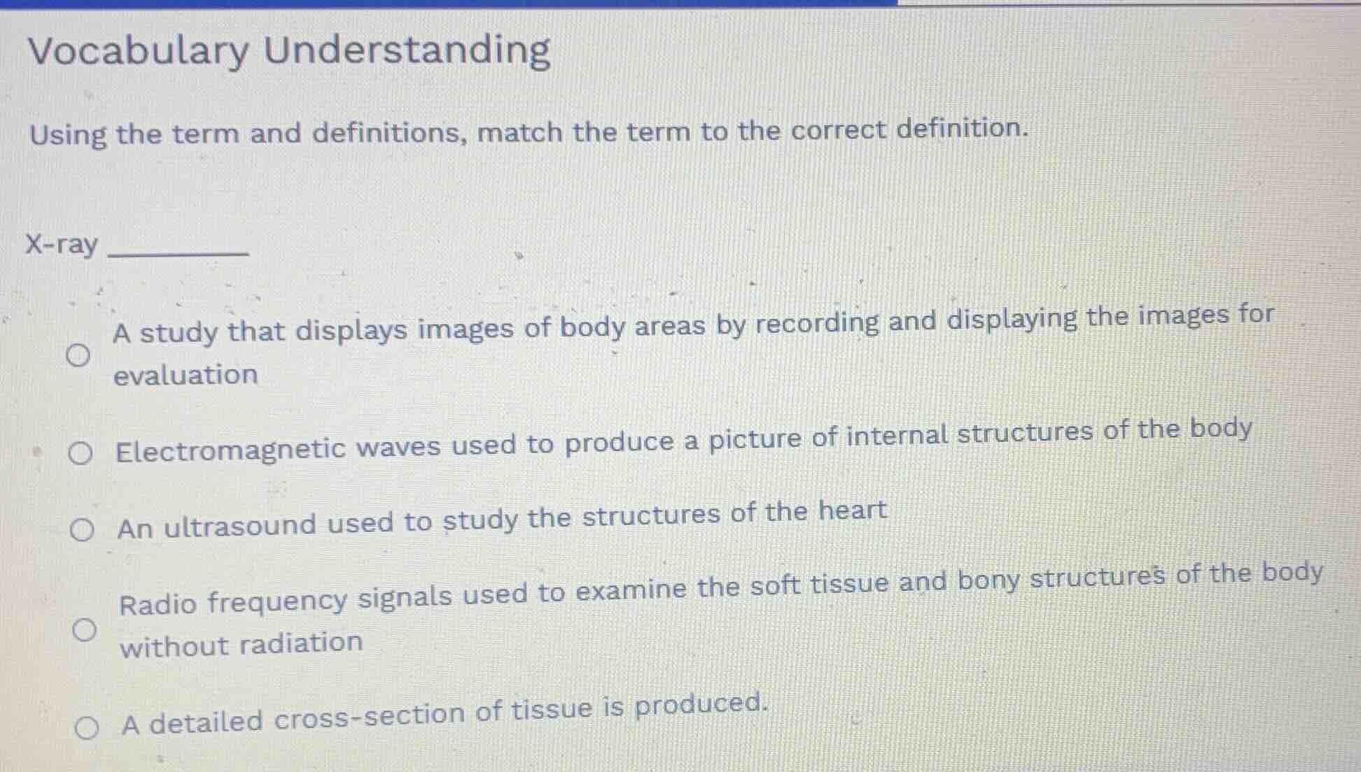 vocabulary understanding using the term and definitions, match the term…