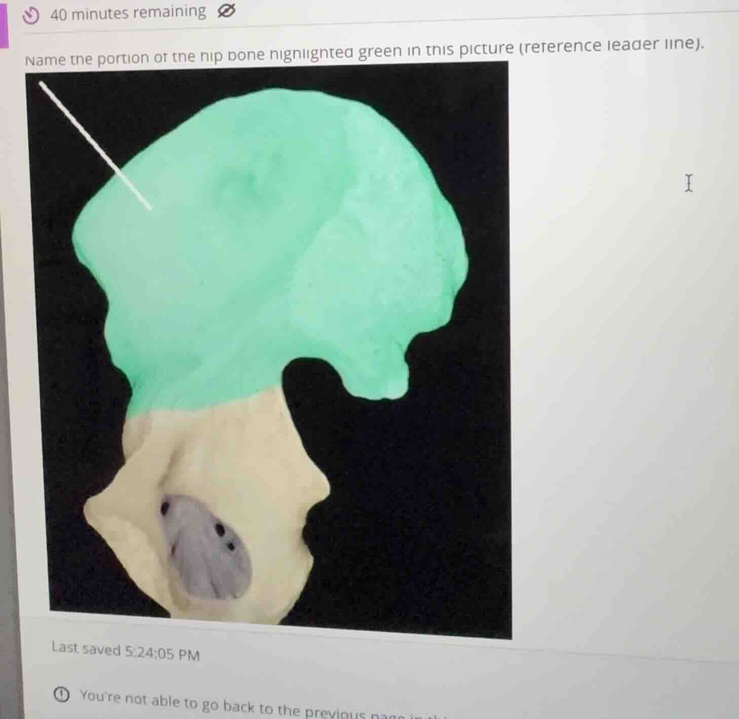 name the portion of the hip bone highlighted green in this picture (ref…