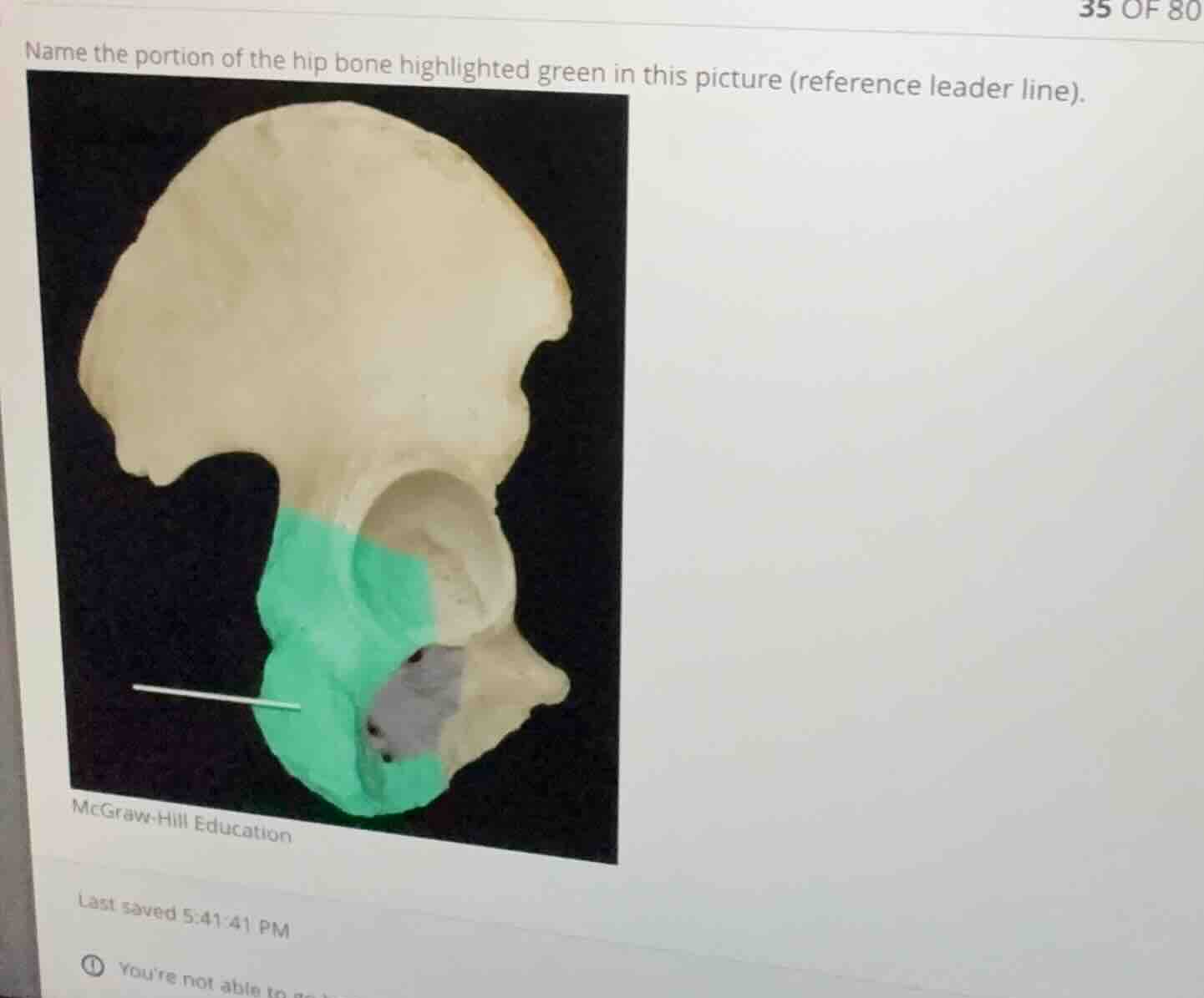 name the portion of the hip bone highlighted green in this picture (ref…
