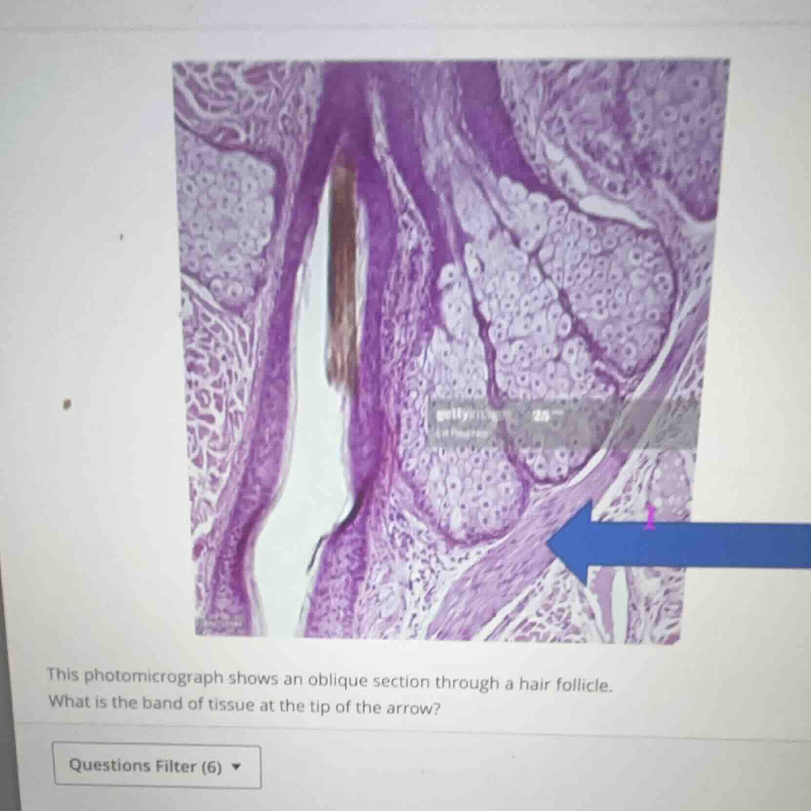 this photomicrograph shows an oblique section through a hair follicle. …