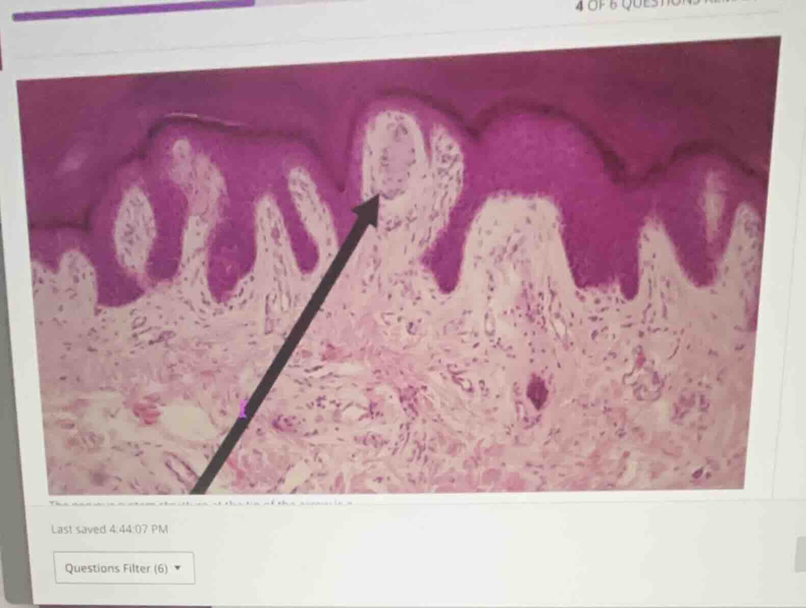 the prominent sensory structure in the skin of the finger is a