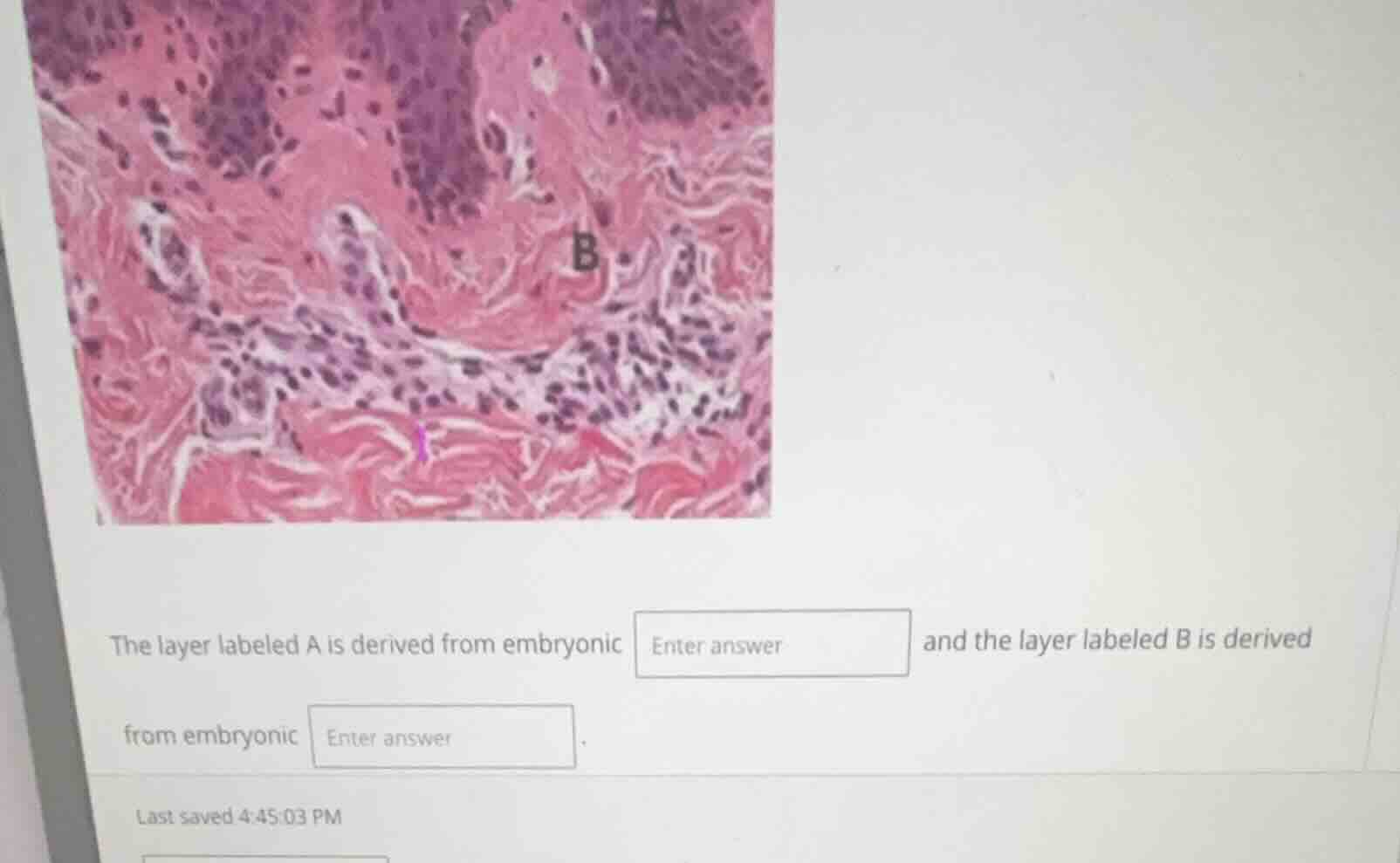the layer labeled a is derived from embryonic enter answer and the laye…