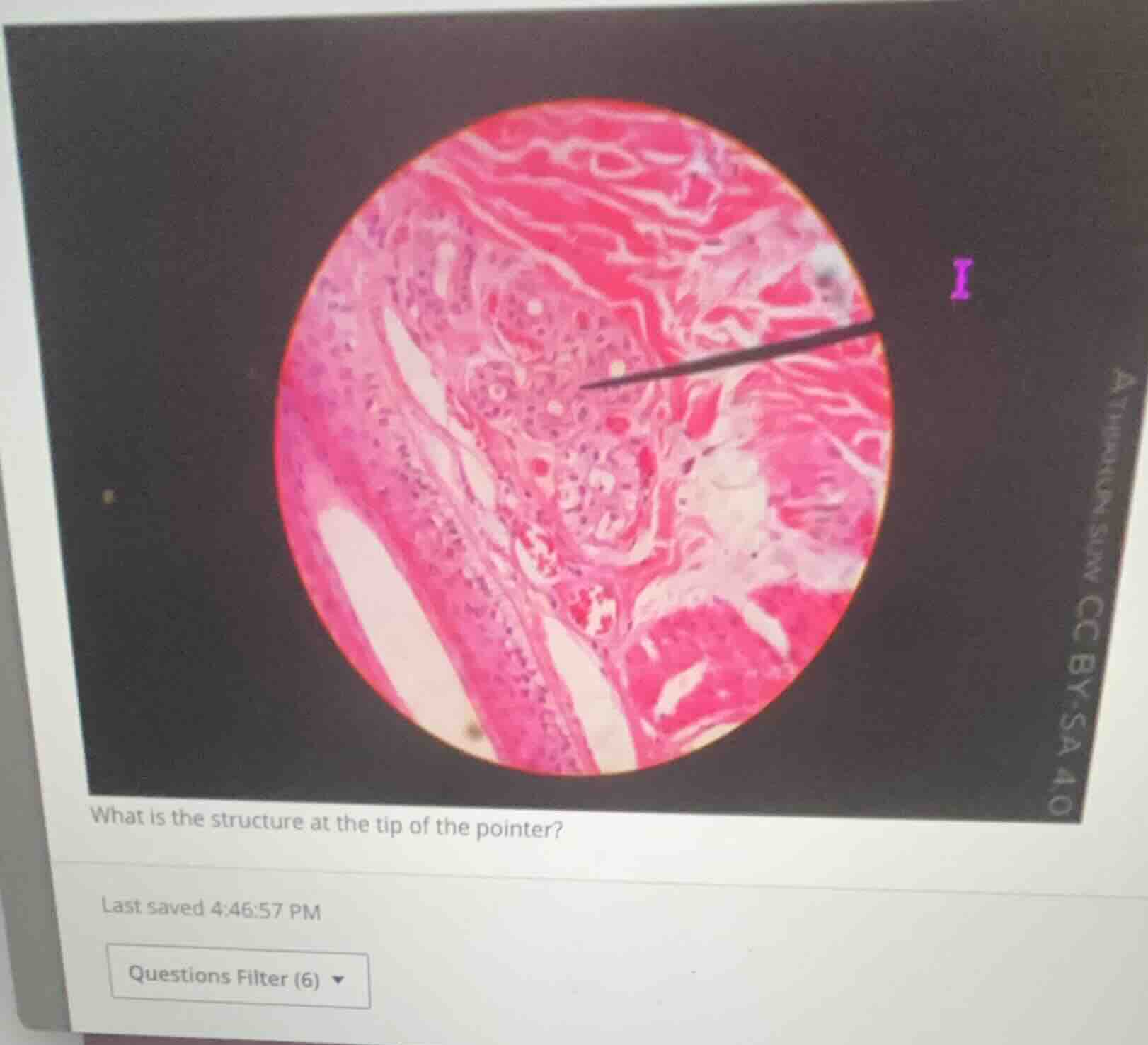 what is the structure at the tip of the pointer?