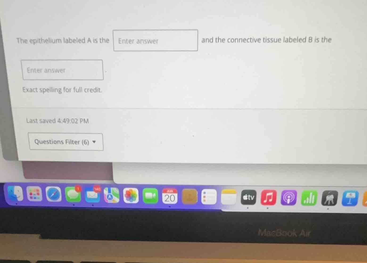 the epithelium labeled a is the enter answer and the connective tissue …
