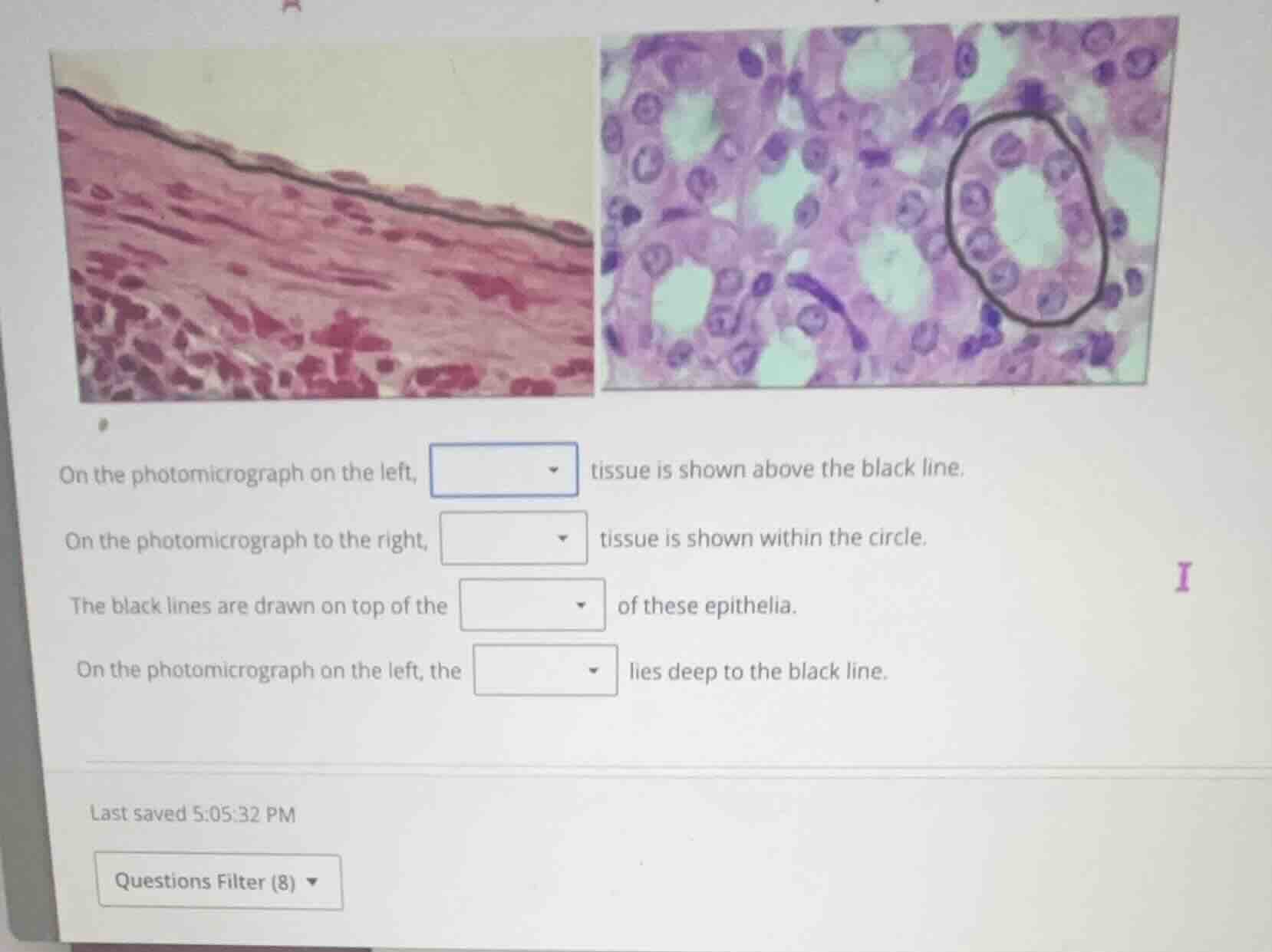 on the photomicrograph on the left, dropdown tissue is shown above the …