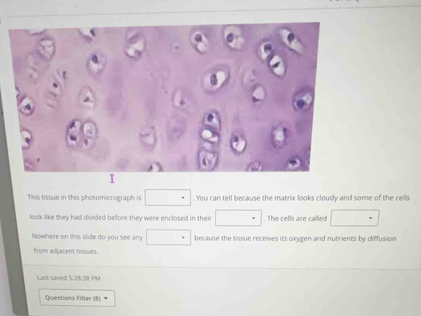 i this tissue in this photomicrograph is dropdown. you can tell because…