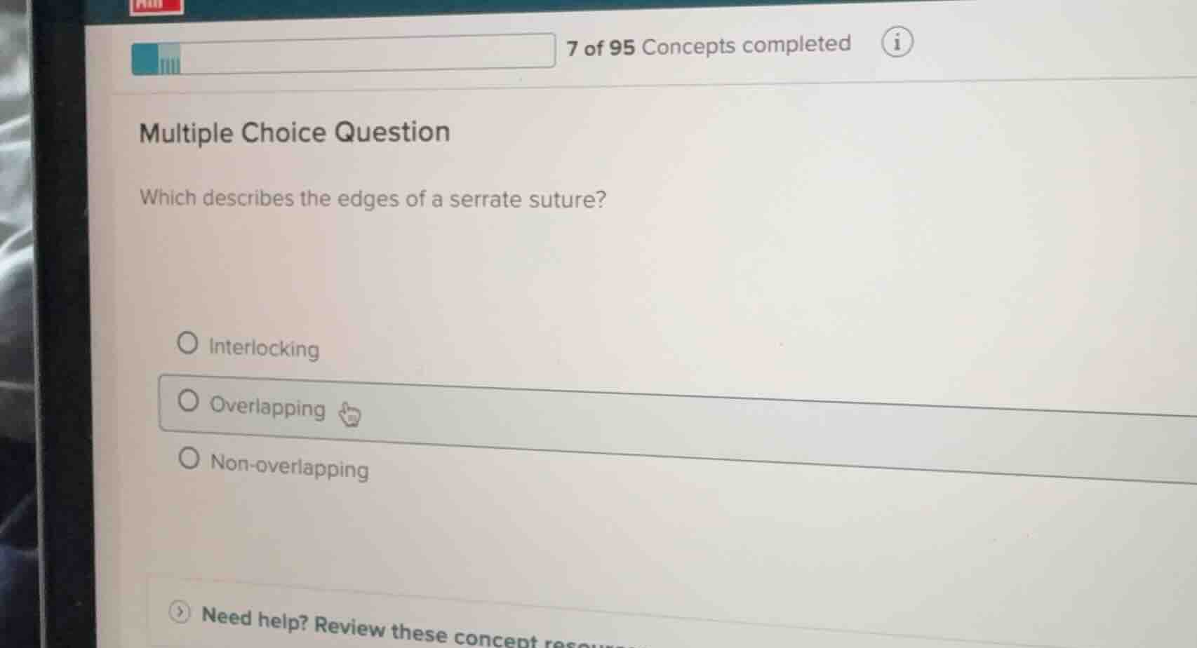 multiple choice question which describes the edges of a serrate suture?…