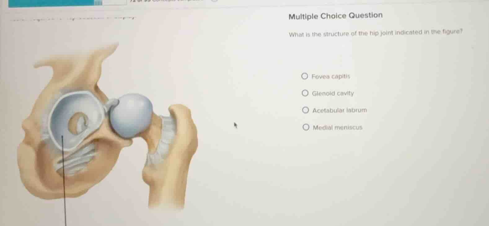 multiple choice question what is the structure of the hip joint indicat…