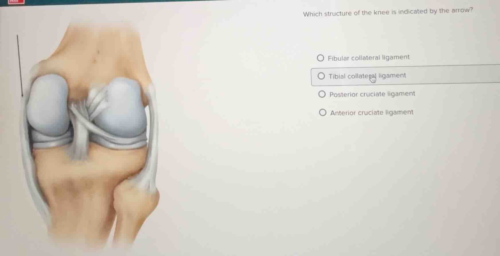 which structure of the knee is indicated by the arrow? fibular collater…