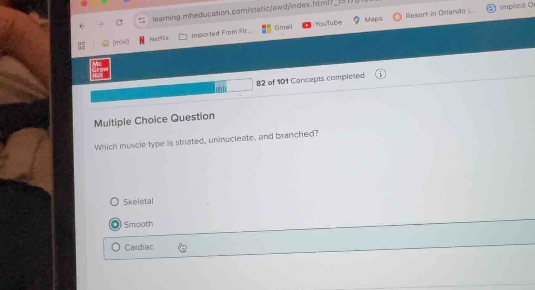 multiple choice question which muscle type is striated, uninucleate, an…
