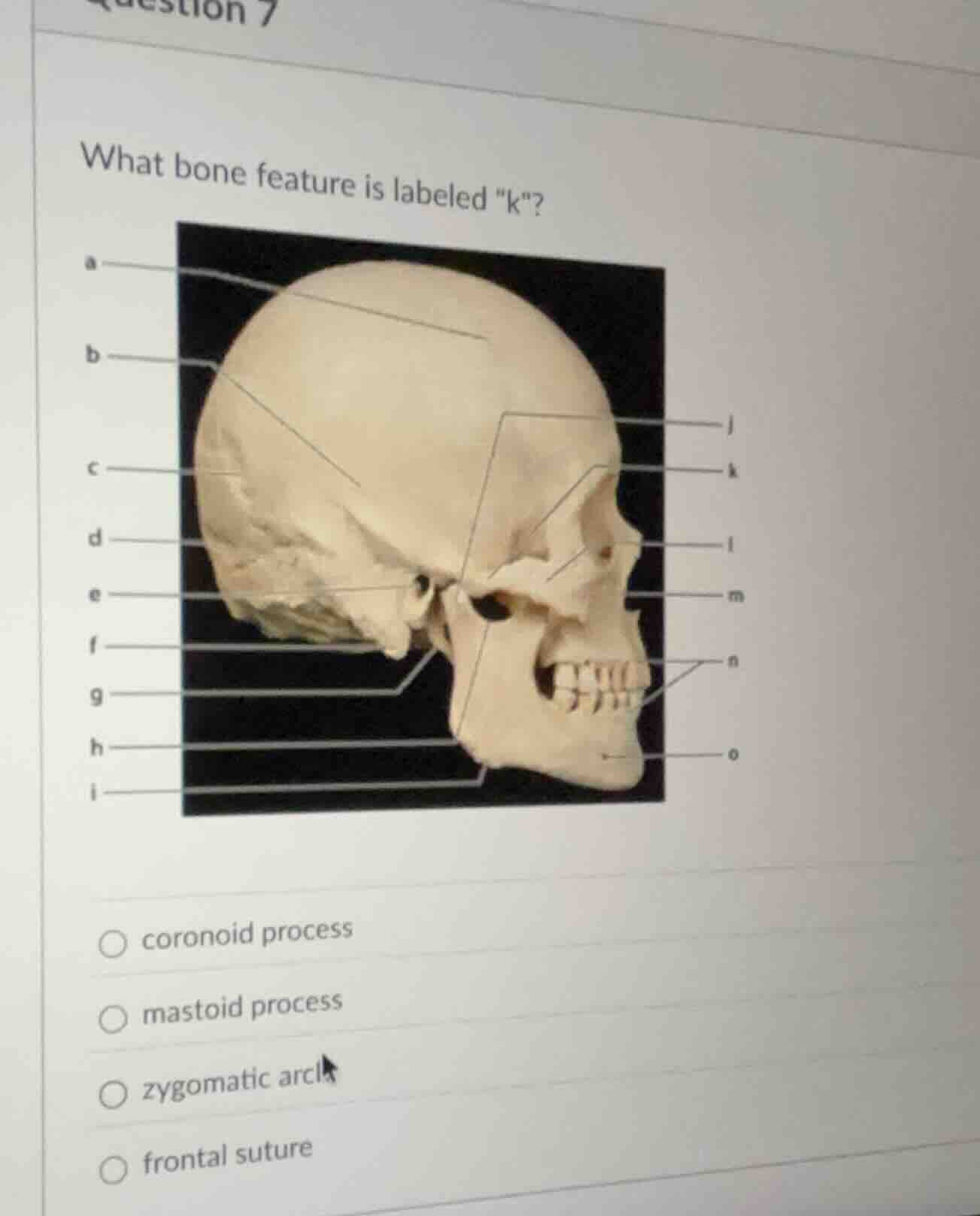 what bone feature is labeled \k\? coronoid process mastoid process zygo…