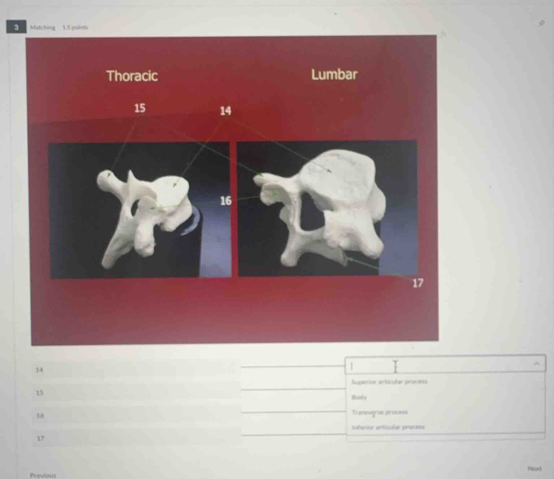 thoracic lumbar 14 15 16 17 14 15 16 17 superior articular process body…