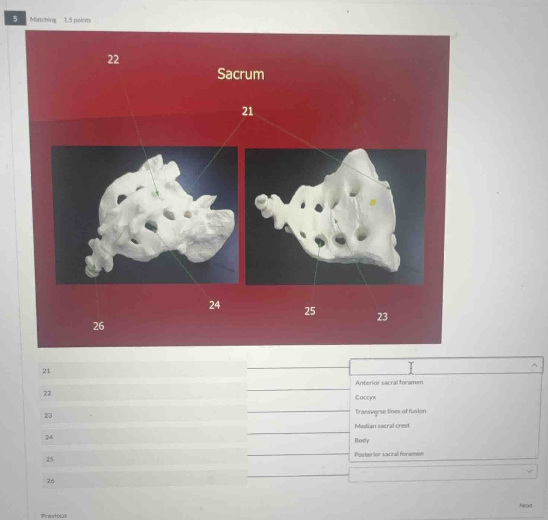 matching 1.5 points sacrum 21 22 23 24 25 26 21 22 23 24 25 26 anterior…