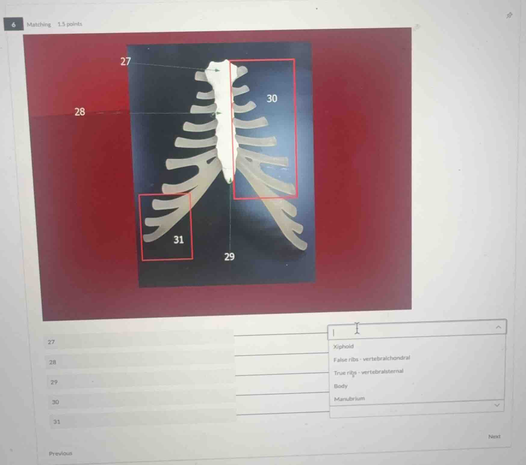 matching 1.5 points 27 28 29 30 31 xiphoid false ribs - vertebrochondra…