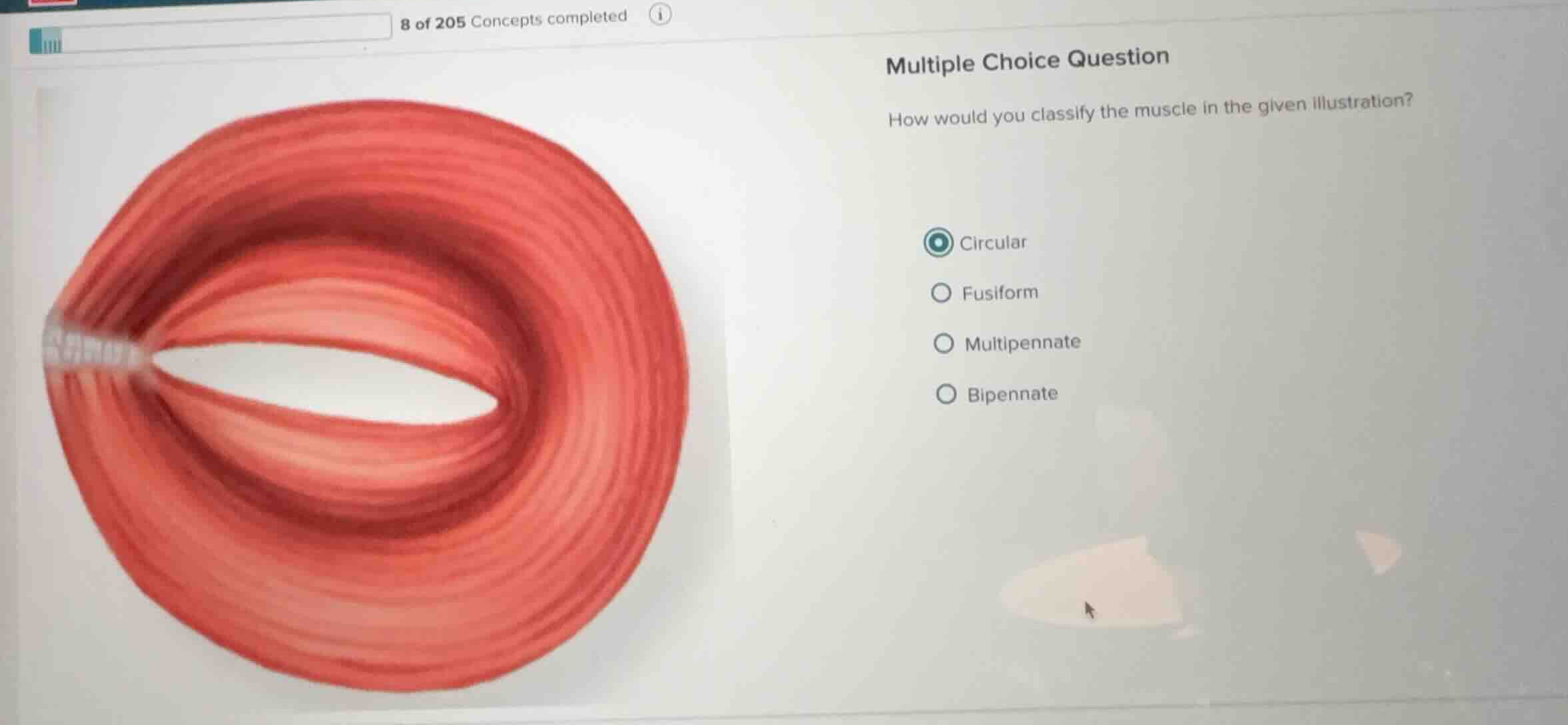 multiple choice question how would you classify the muscle in the given…