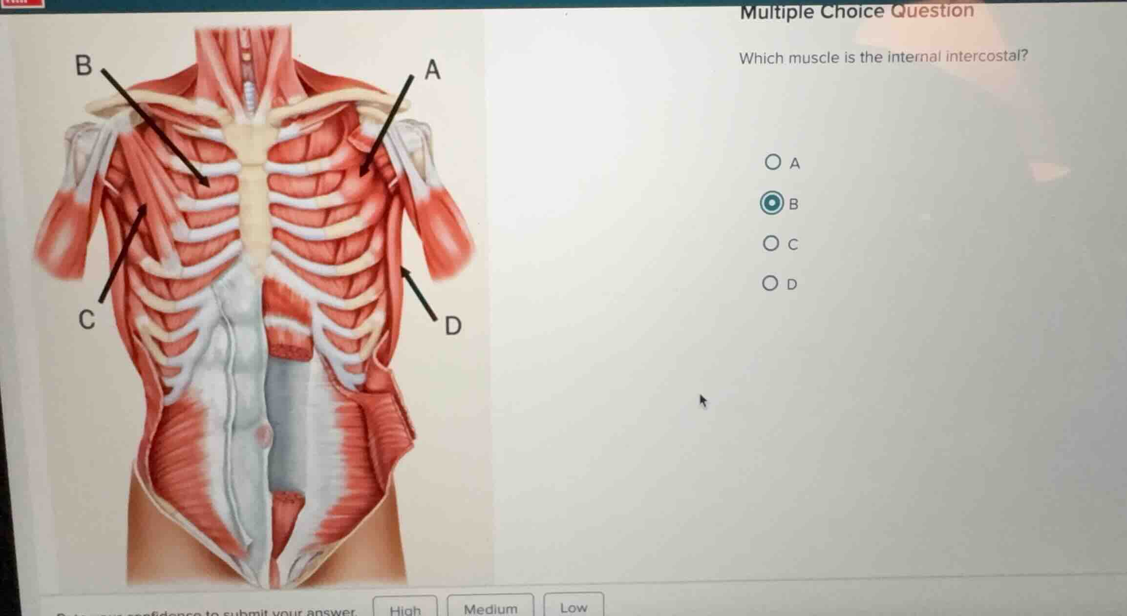 multiple choice question which muscle is the internal intercostal? a b …