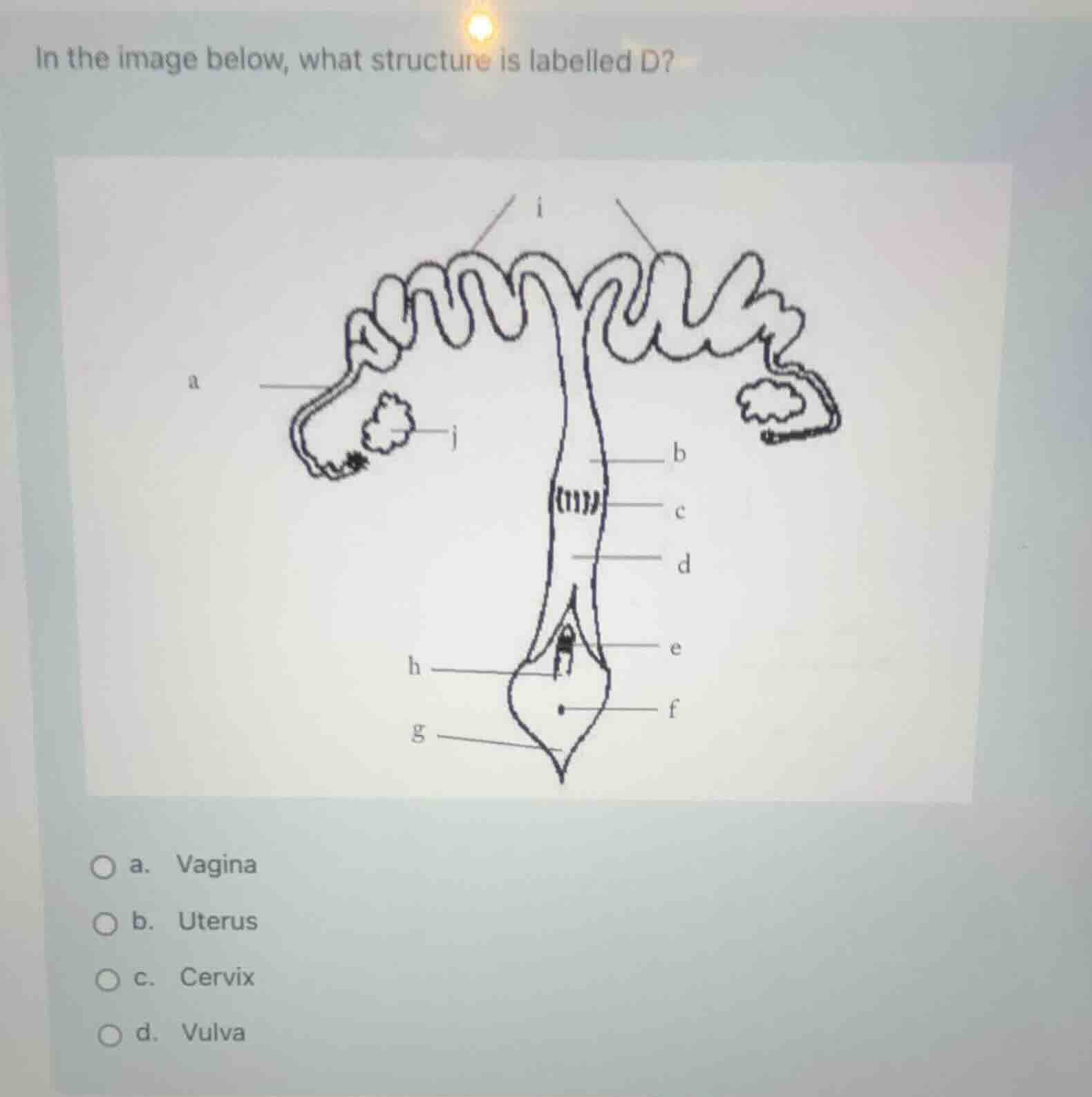 in the image below, what structure is labelled d? a. vagina b. uterus c…