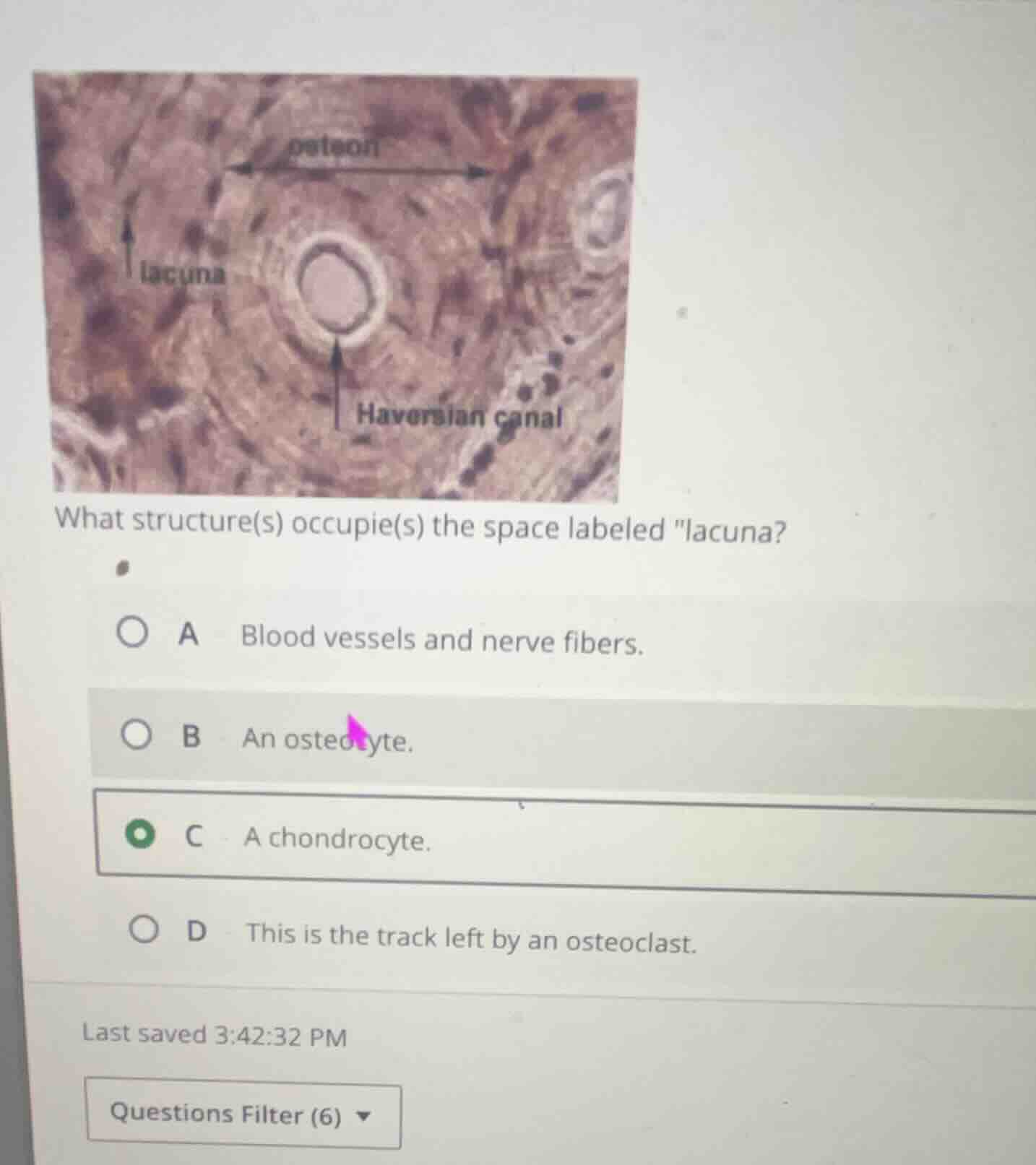 what structure(s) occupie(s) the space labeled \lacuna\? a blood vessel…