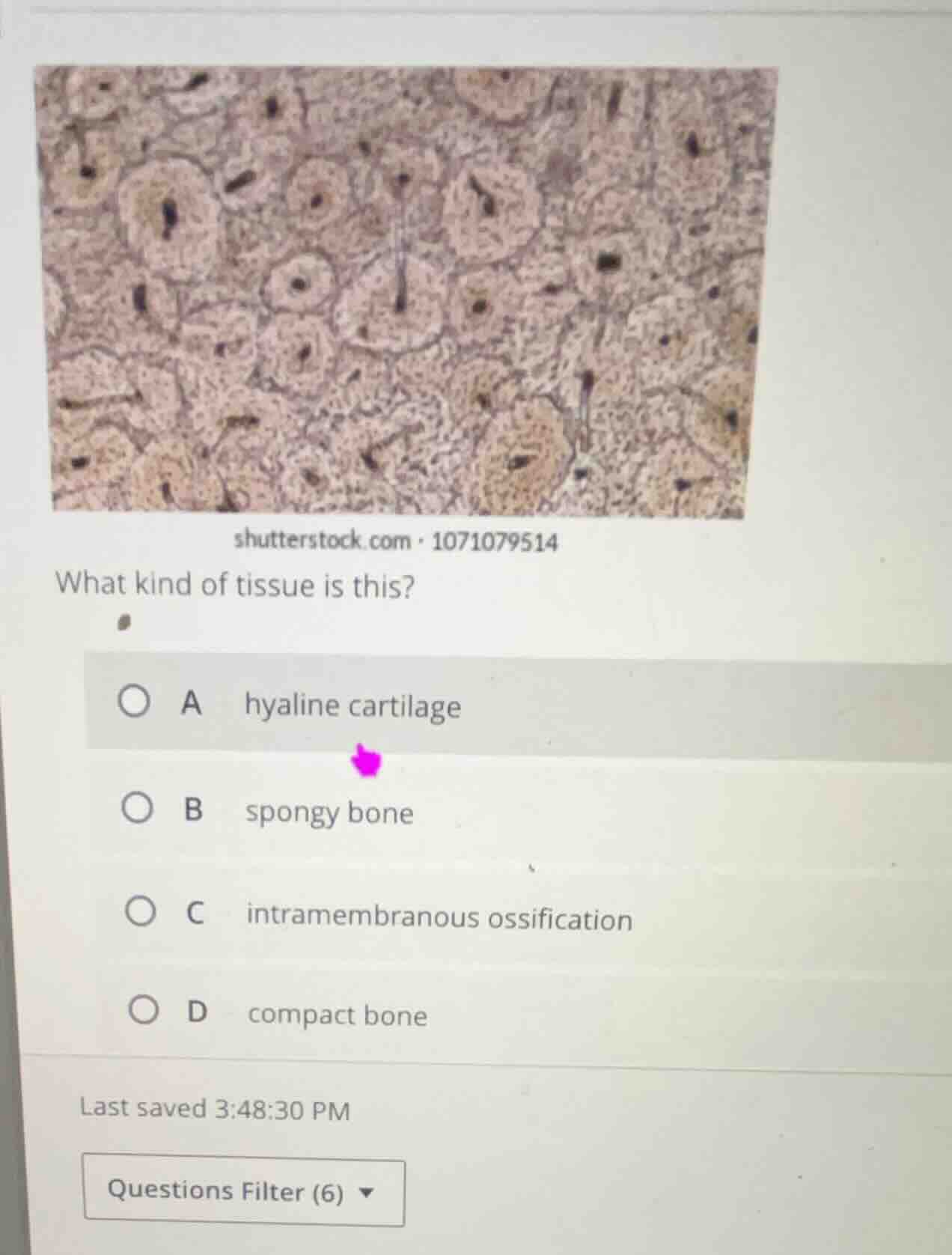 what kind of tissue is this? a hyaline cartilage b spongy bone c intram…