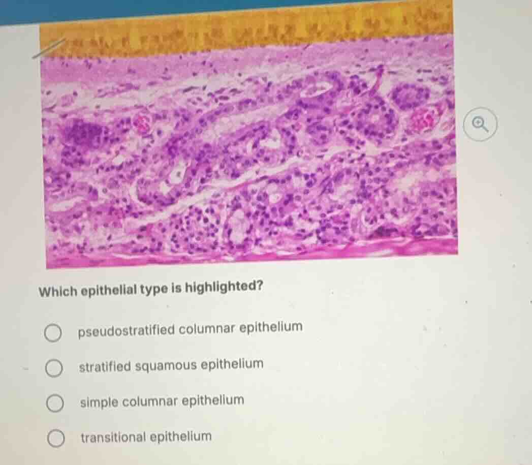 which epithelial type is highlighted? pseudostratified columnar epithel…