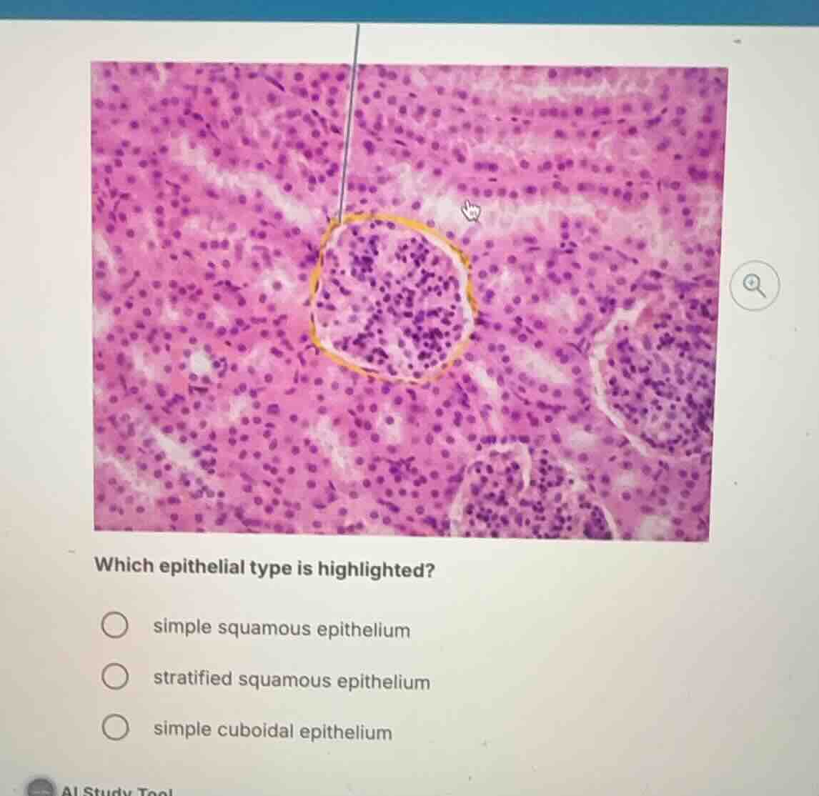 which epithelial type is highlighted? simple squamous epithelium strati…