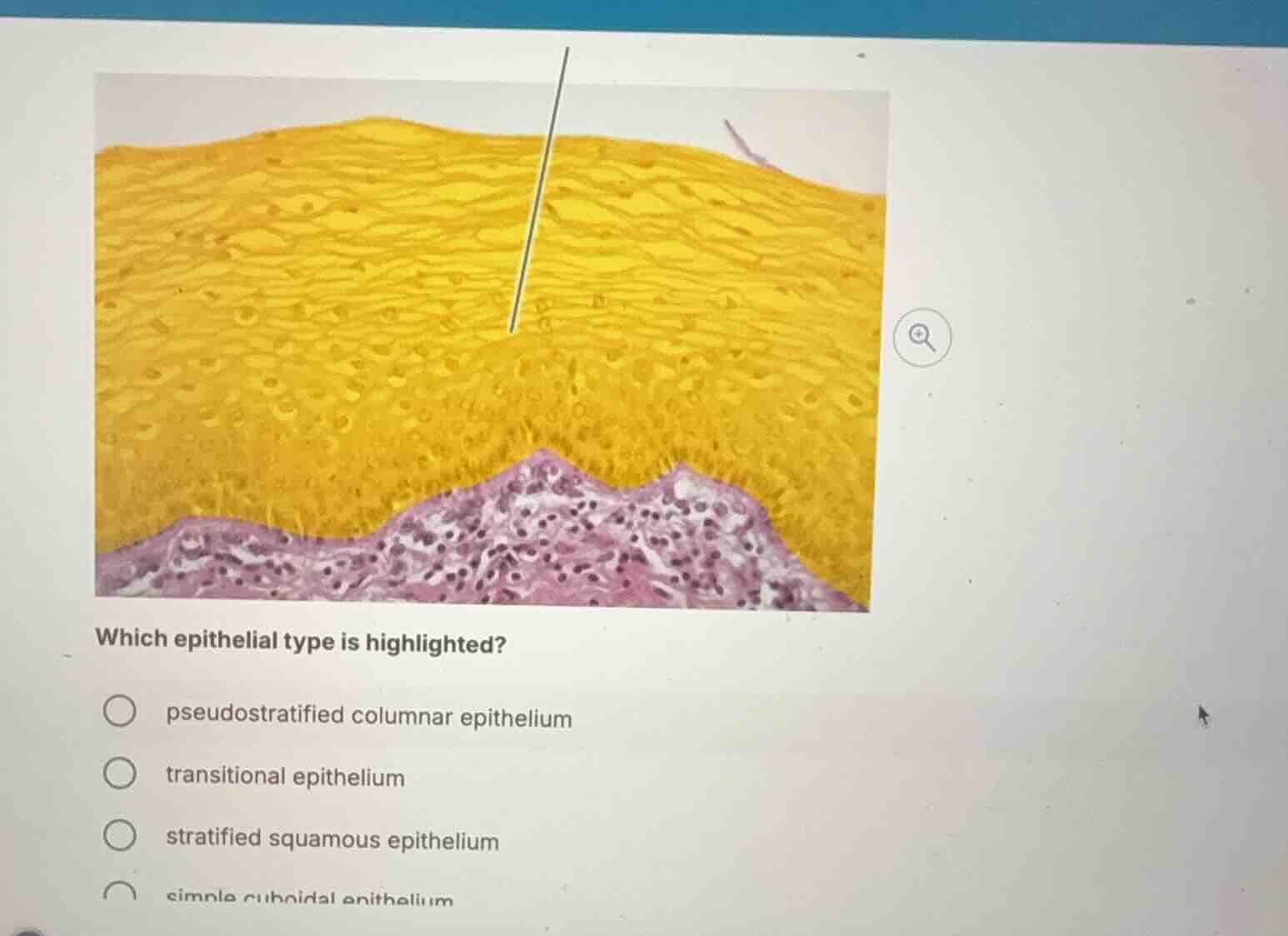 which epithelial type is highlighted? pseudostratified columnar epithel…