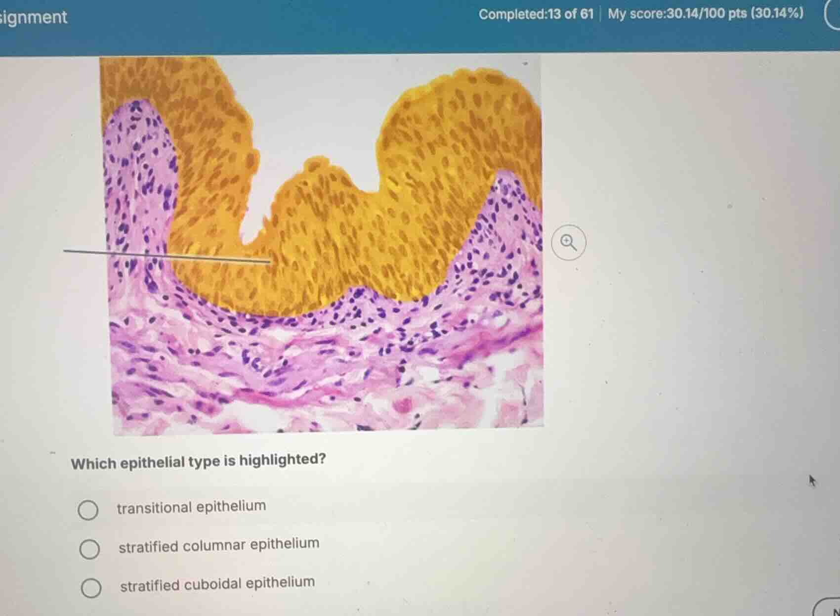 which epithelial type is highlighted? transitional epithelium stratifie…