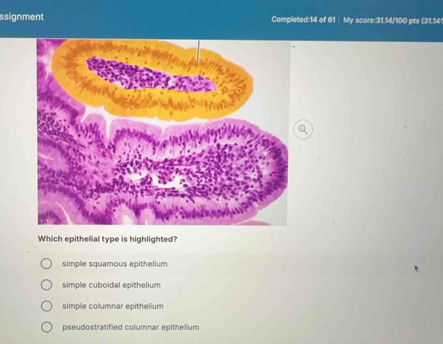 which epithelial type is highlighted? simple squamous epithelium simple…