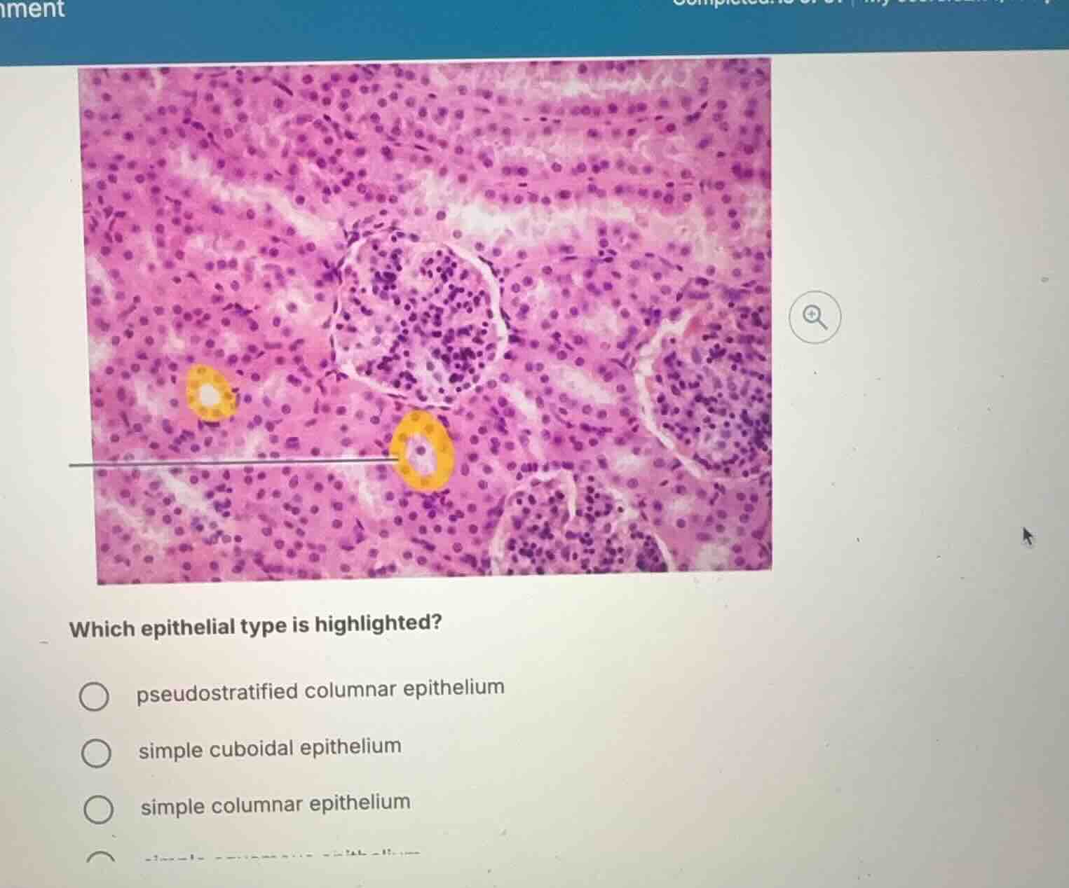 which epithelial type is highlighted? pseudostratified columnar epithel…