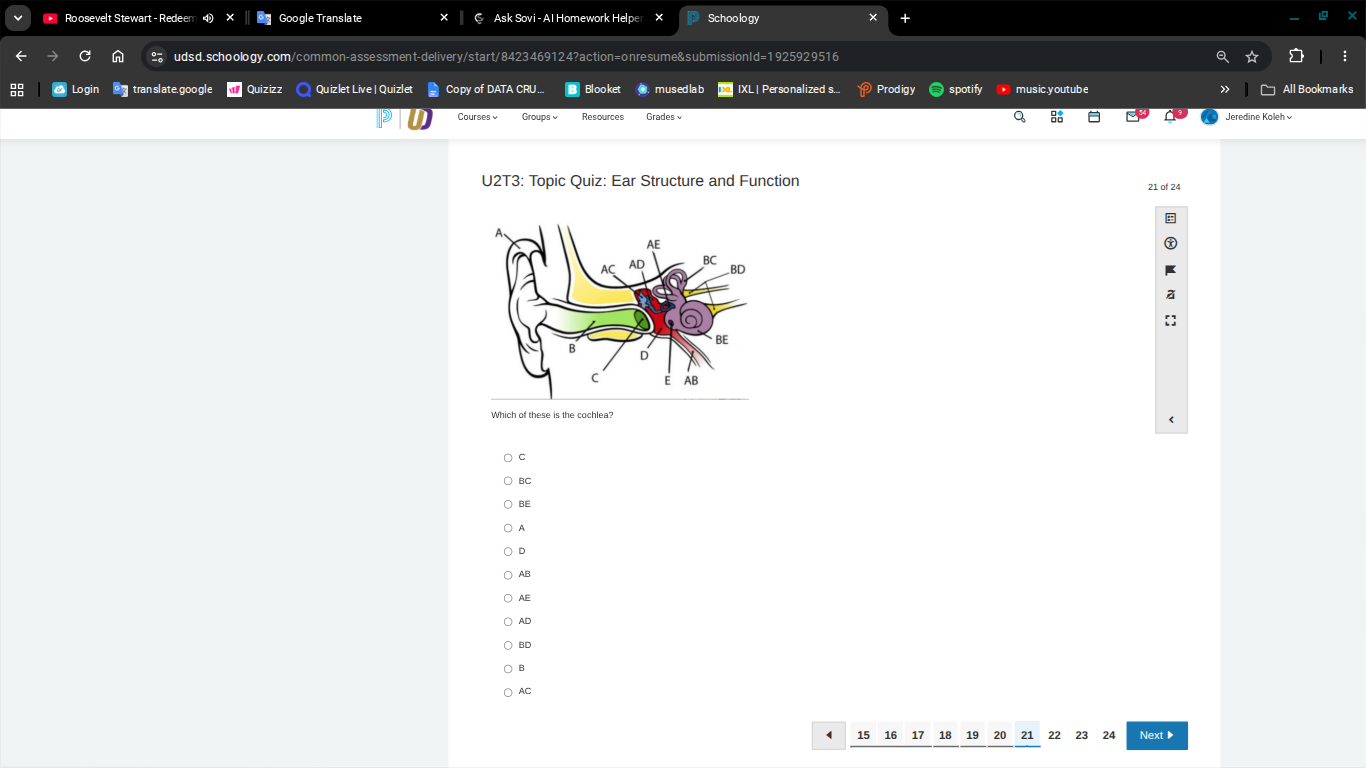 u2t3: topic quiz: ear structure and function which of these is the coch…