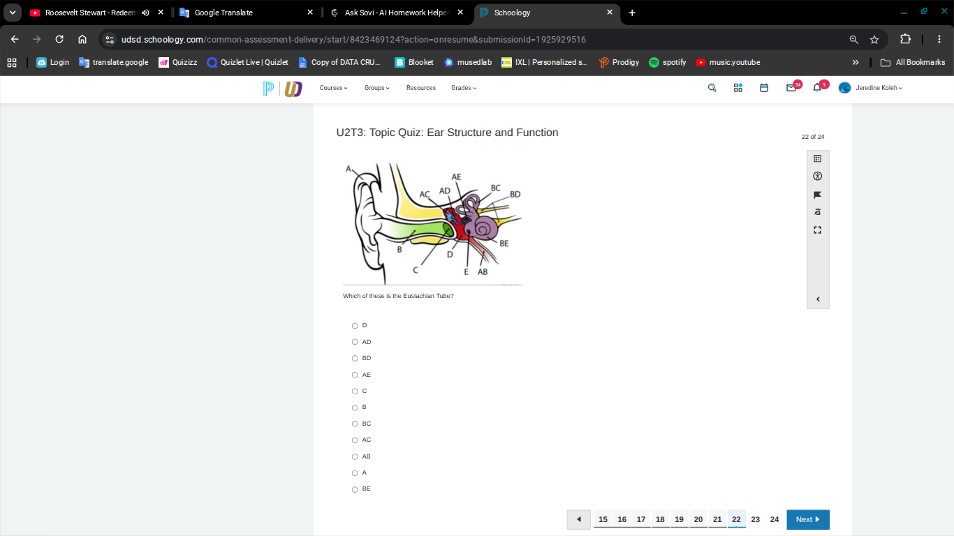 u2t3: topic quiz: ear structure and function which of these is the eust…
