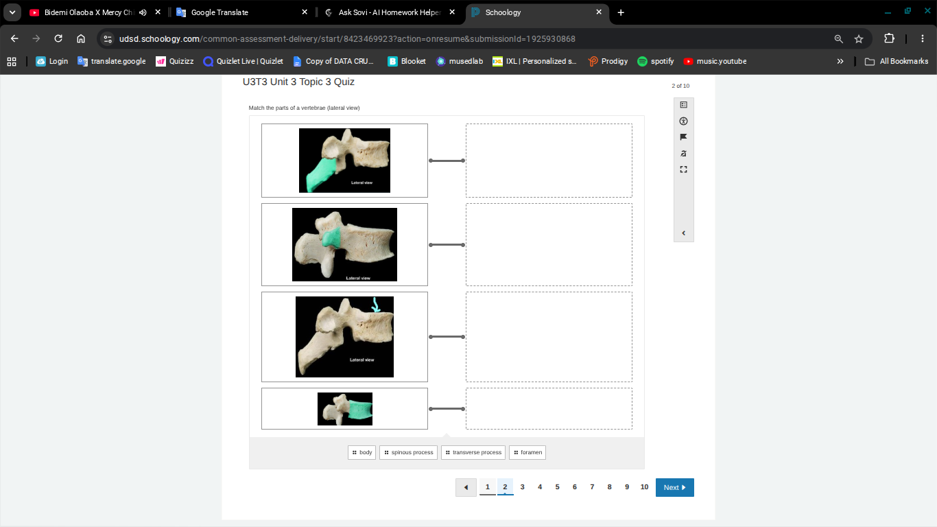 u3t3 unit 3 topic 3 quiz match the parts of a vertebrae (lateral view) …