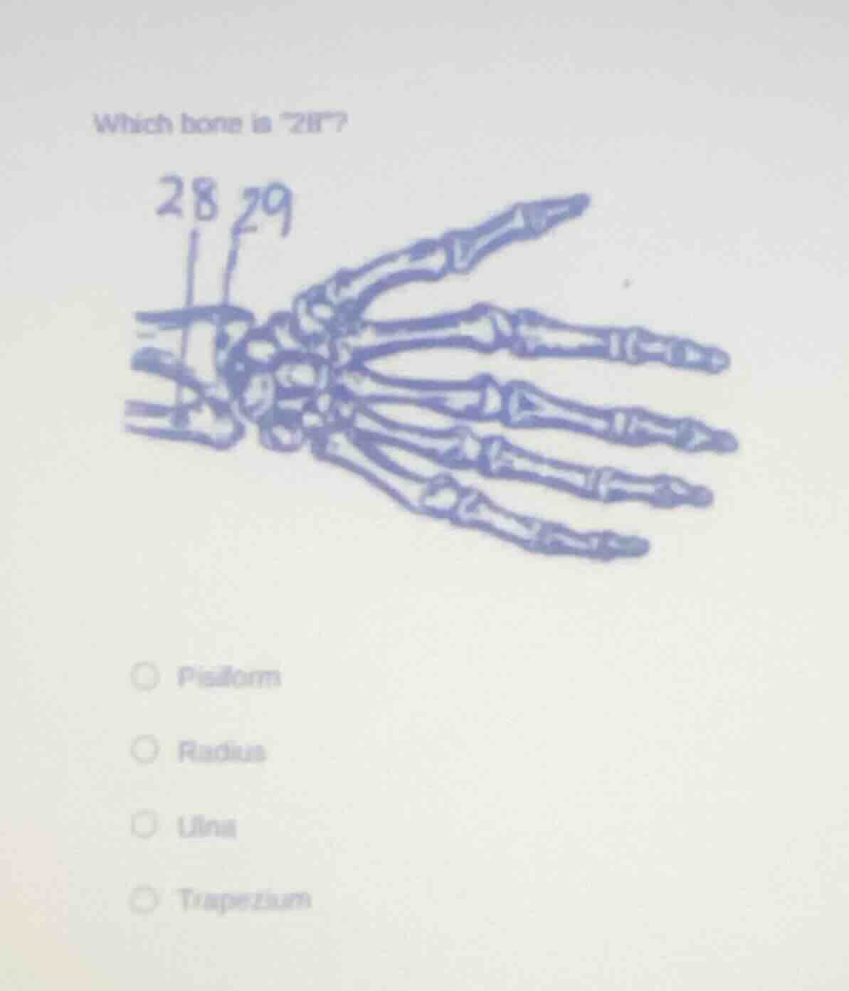 which bone is \28\? pisiform radius ulna trapezium