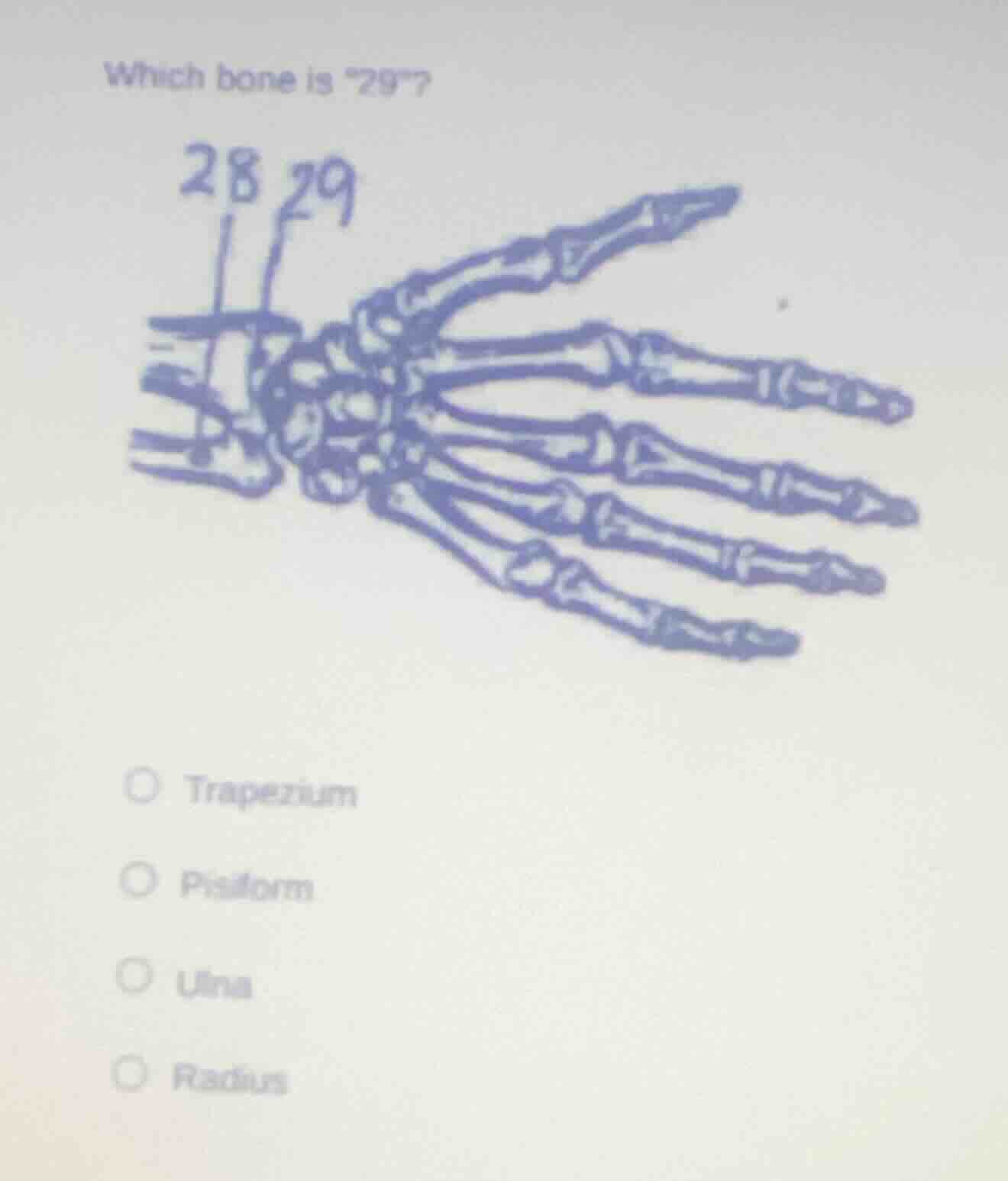 which bone is \29\? trapezium pisiform ulna radius