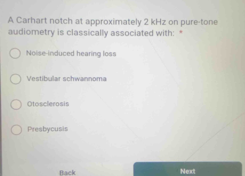 a carhart notch at approximately 2 khz on pure-tone audiometry is class…