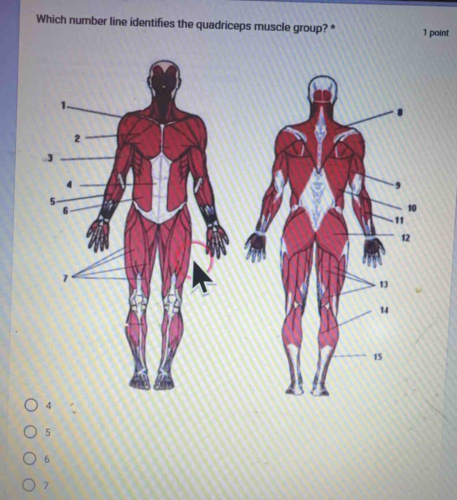 which number line identifies the quadriceps muscle group? * 1 point 4 5…