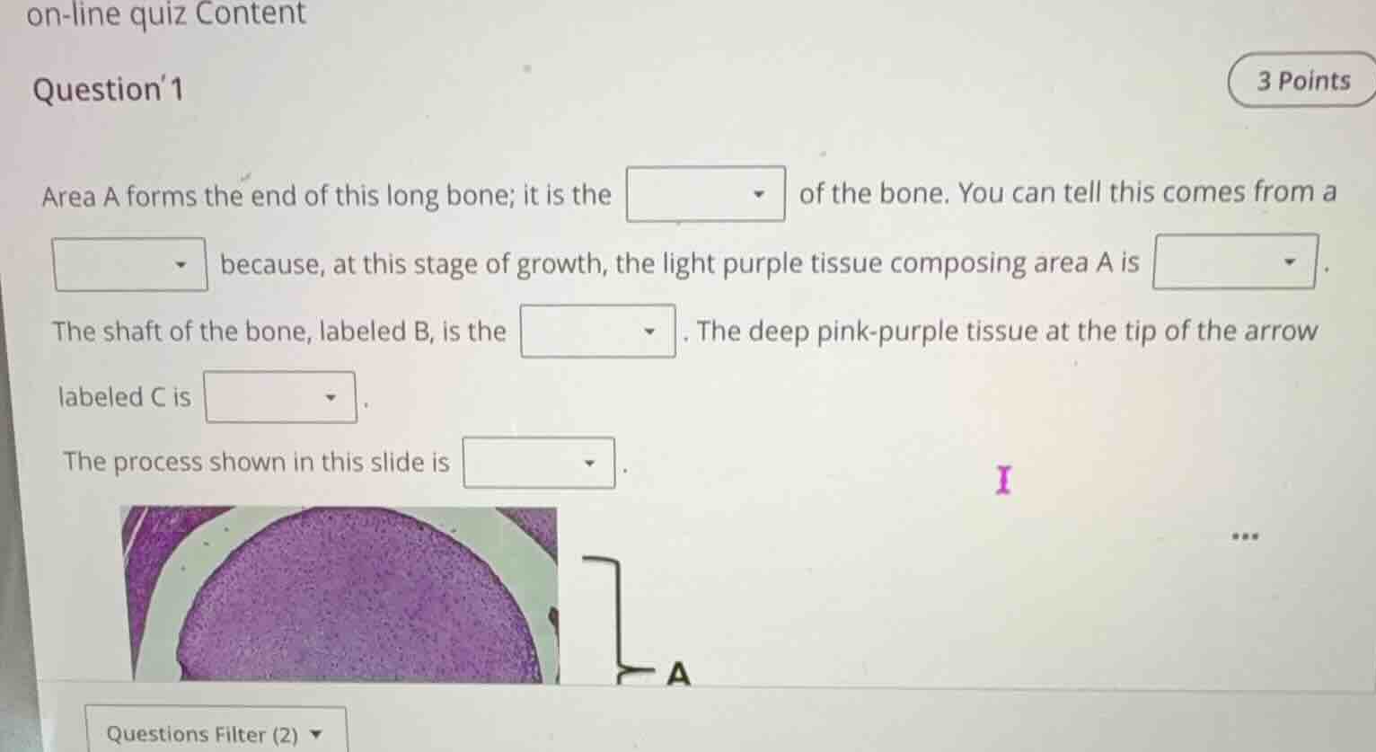 question 1 area a forms the end of this long bone; it is the dropdown o…