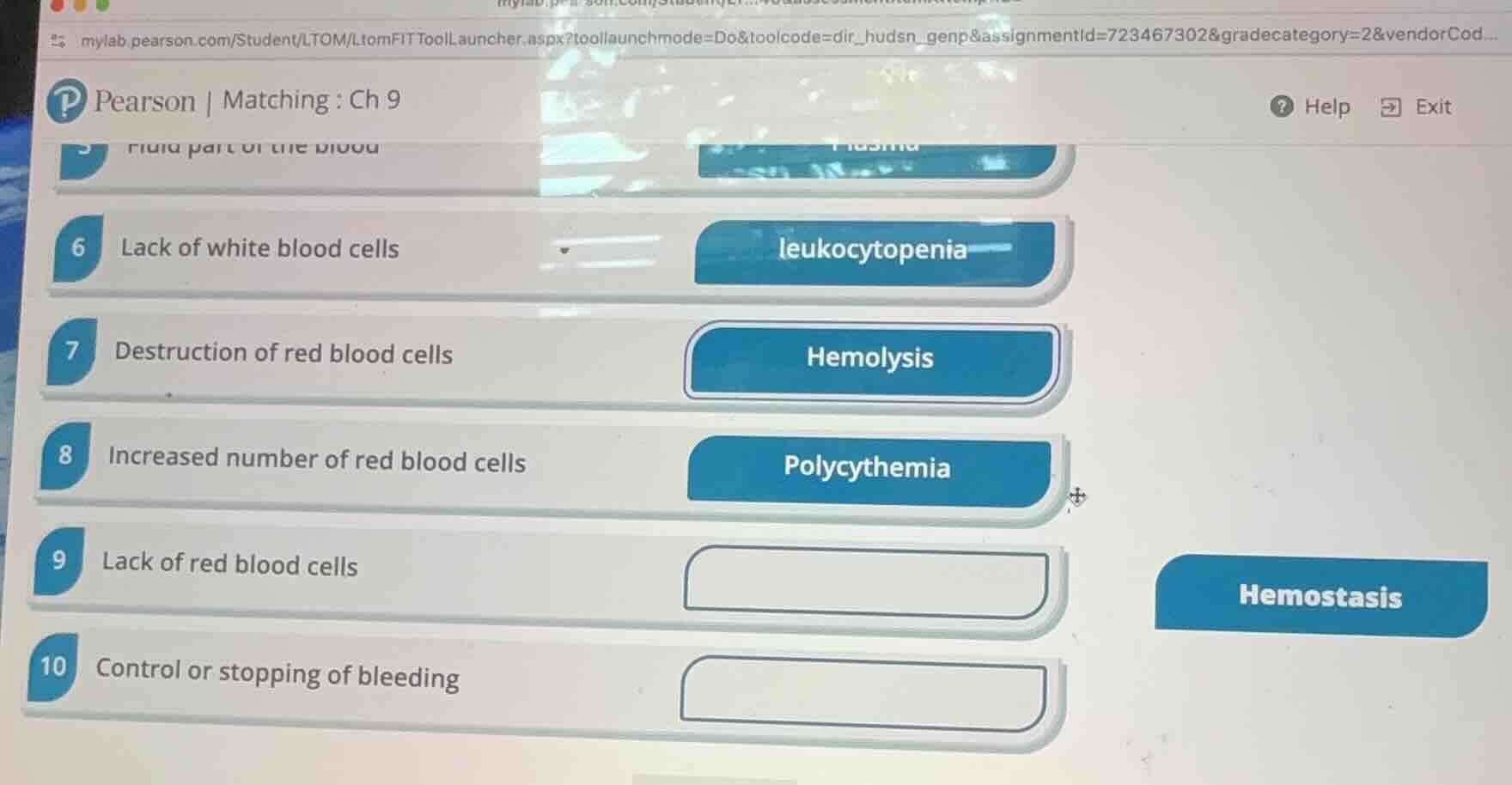 6 lack of white blood cells - leukocytopenia 7 destruction of red blood…
