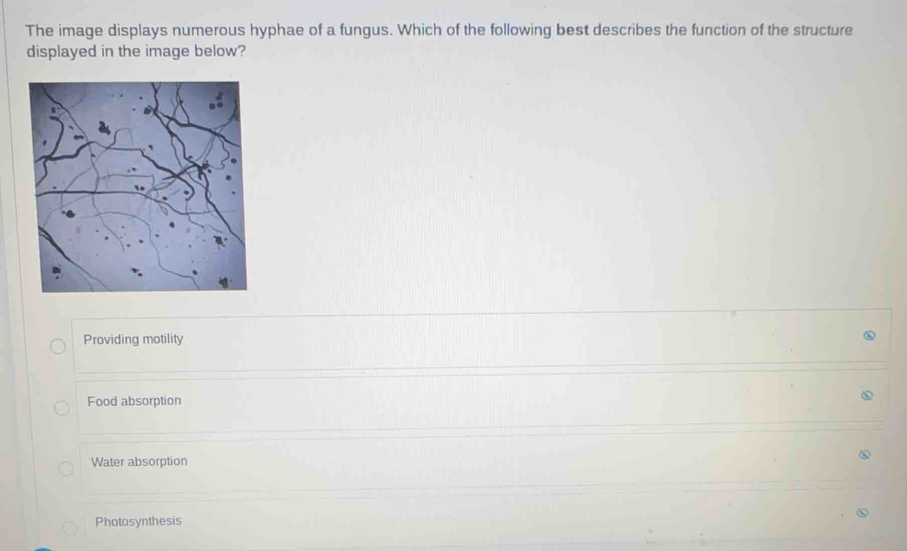 the image displays numerous hyphae of a fungus. which of the following …