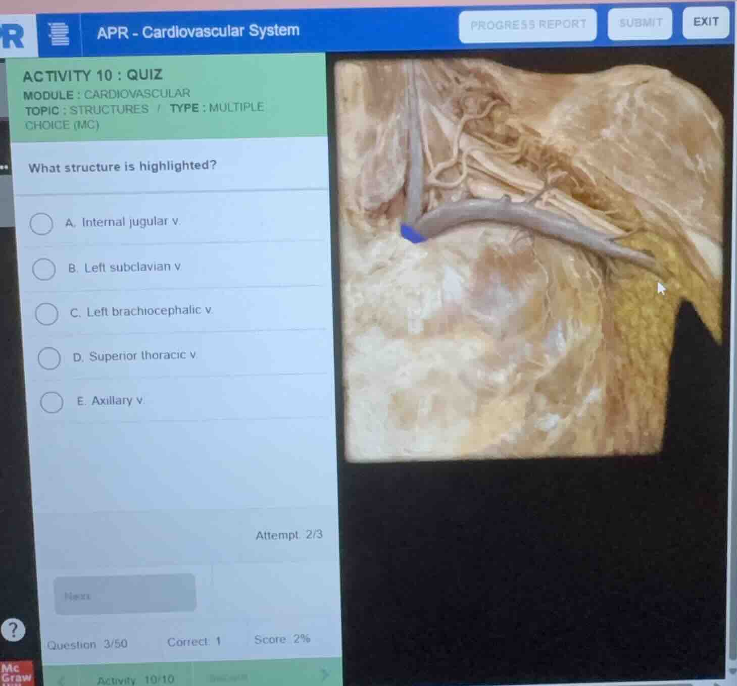 activity 10: quiz module: cardiovascular topic: structures / type: mult…