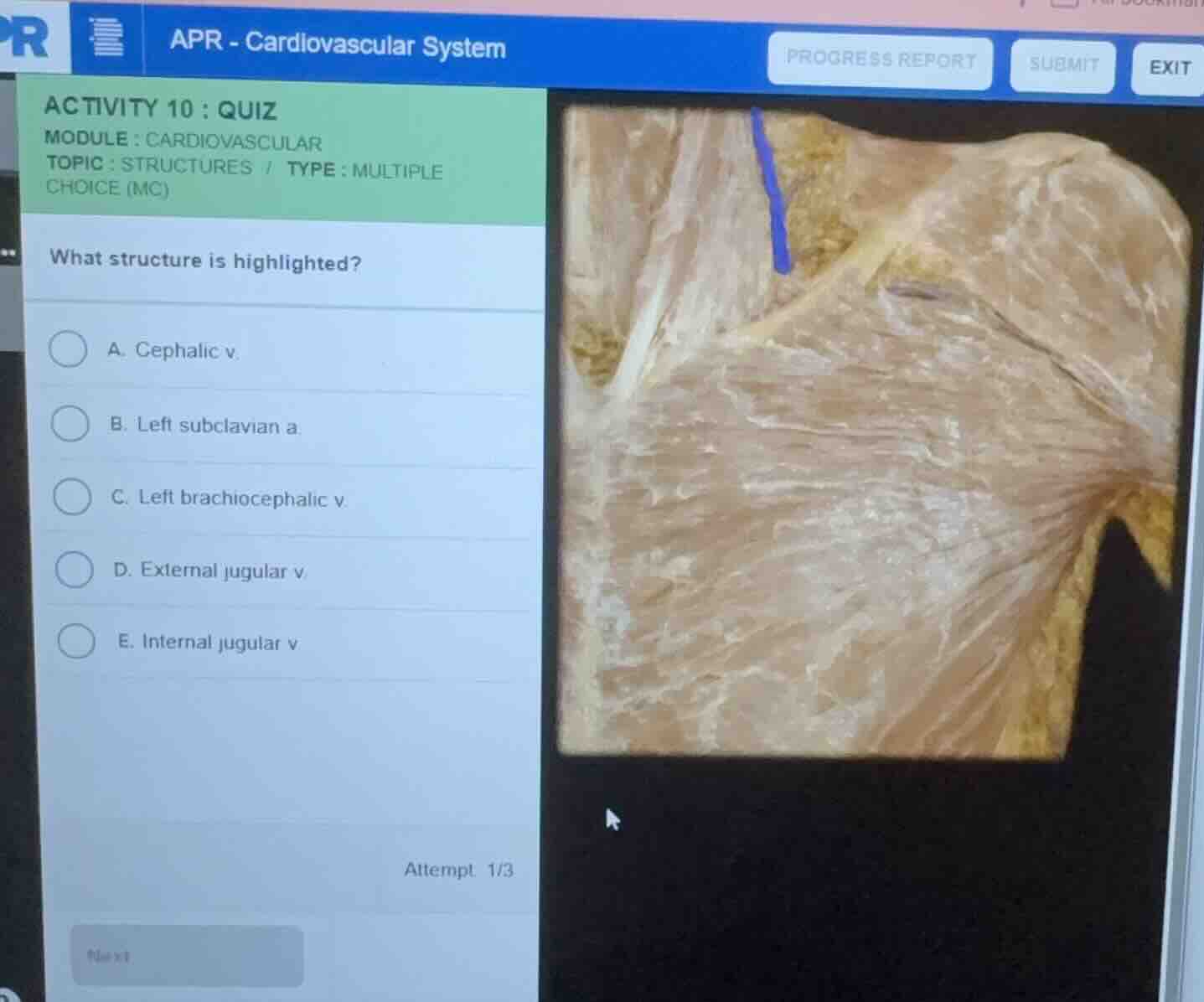 apr - cardiovascular system activity 10: quiz module: cardiovascular to…