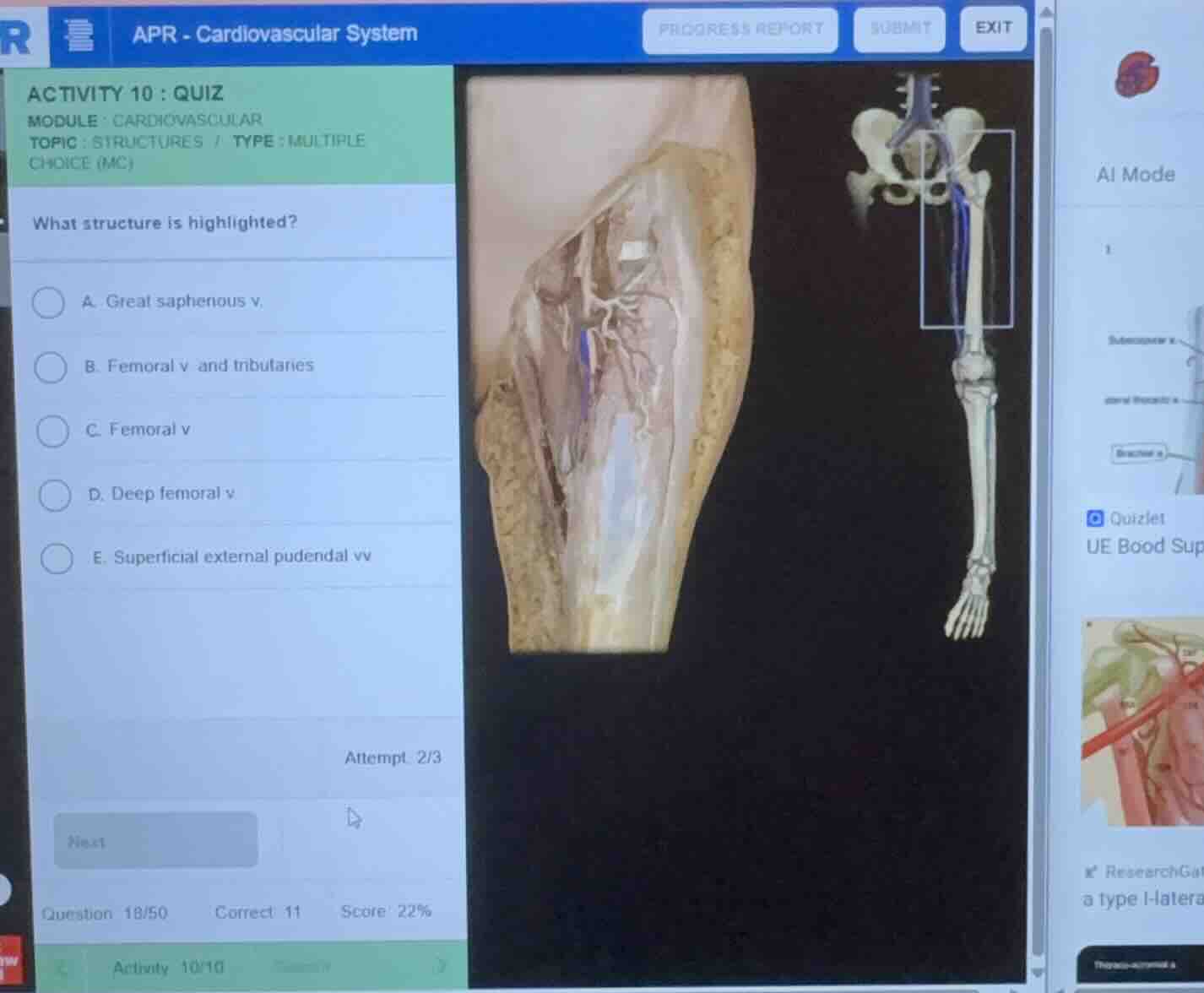 what structure is highlighted? a. great saphenous v. b. femoral v. and …
