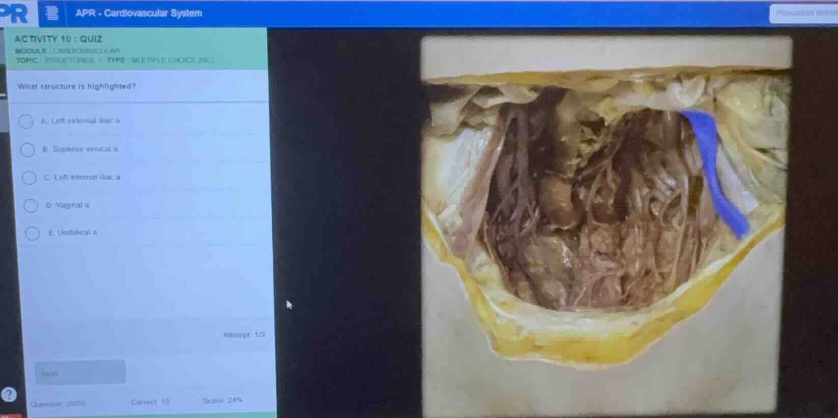 what structure is highlighted? a. left external iliac a. b. superior ve…