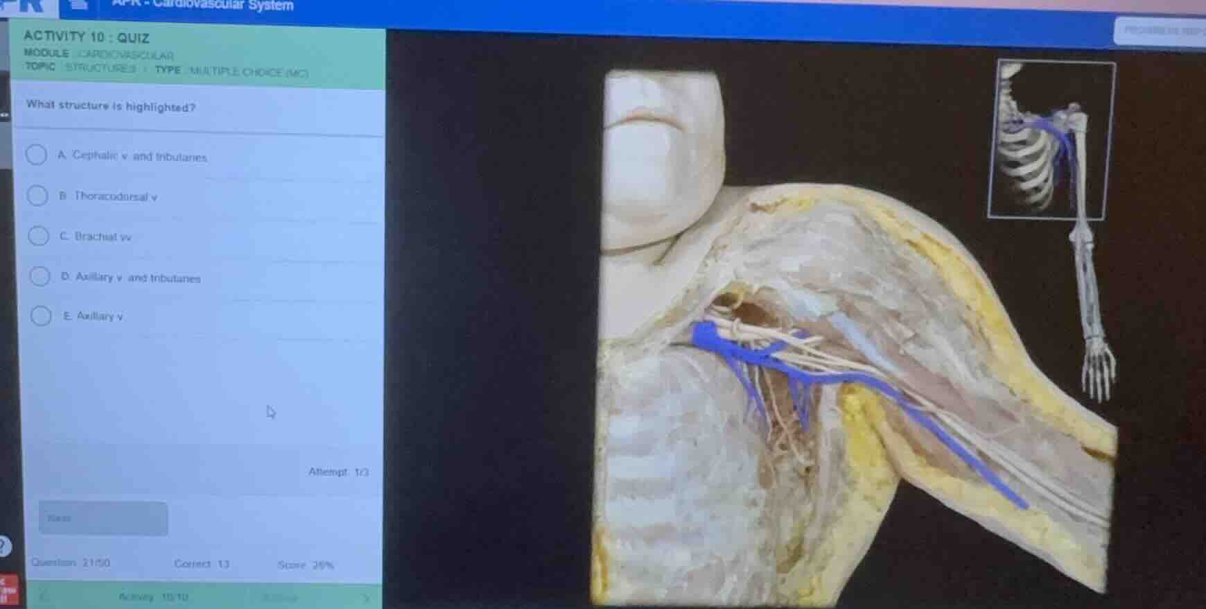 activity 10: quiz module: cardiovascular topic: structures | type: mult…