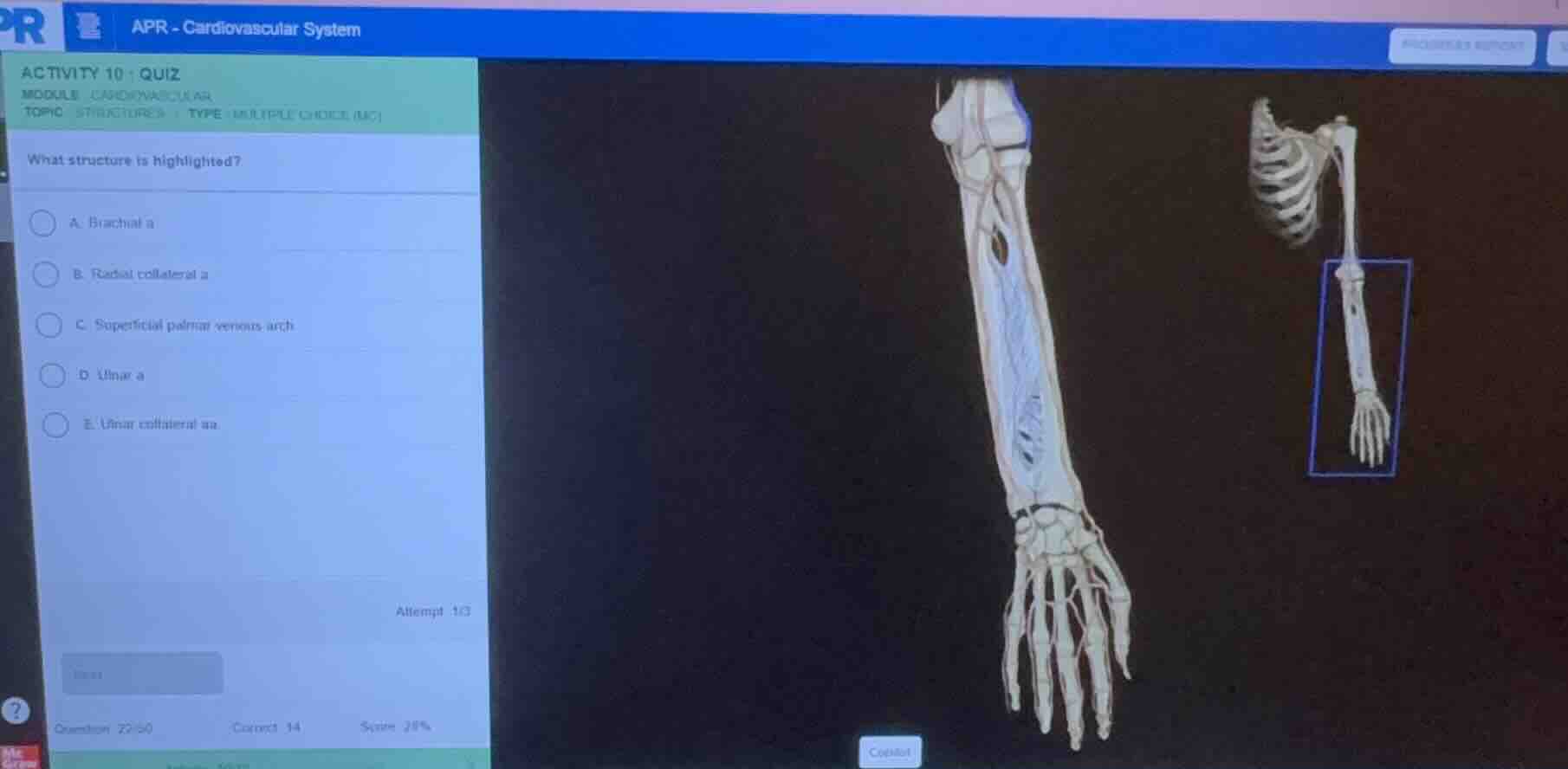 what structure is highlighted? a. brachial a. b. radial collateral a. c…
