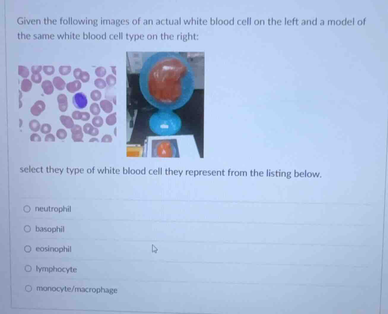 given the following images of an actual white blood cell on the left an…