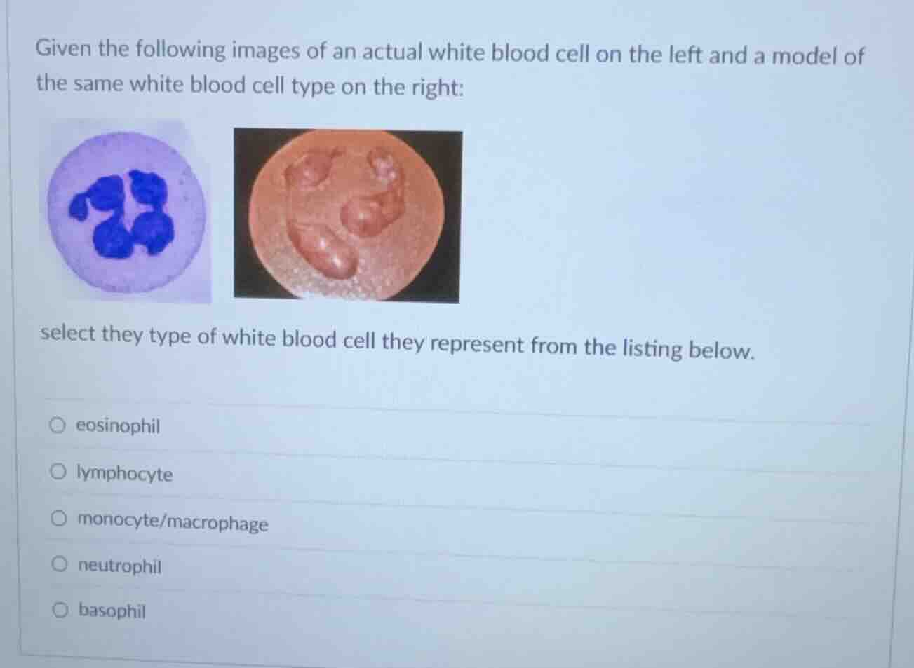 given the following images of an actual white blood cell on the left an…