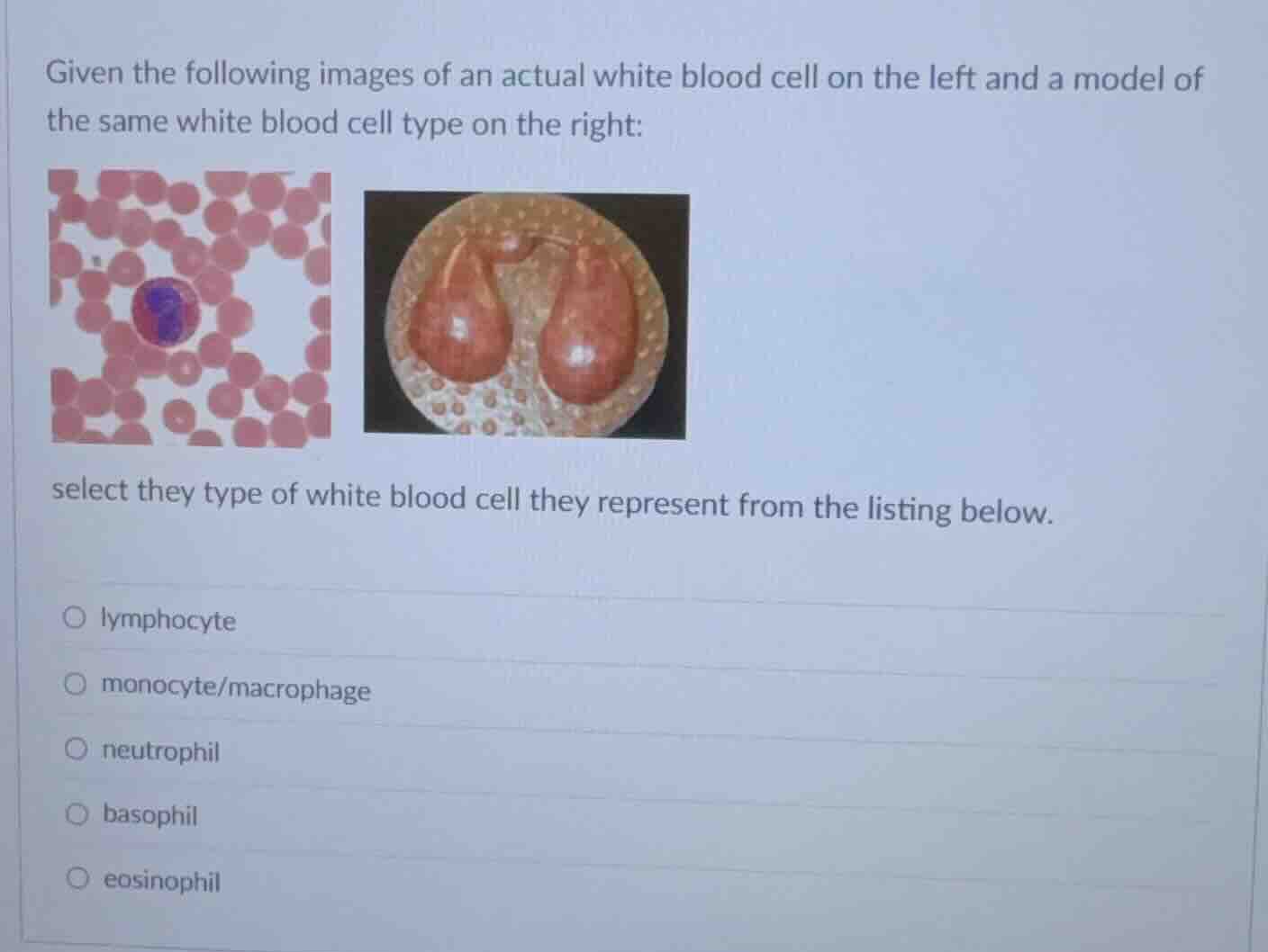 given the following images of an actual white blood cell on the left an…