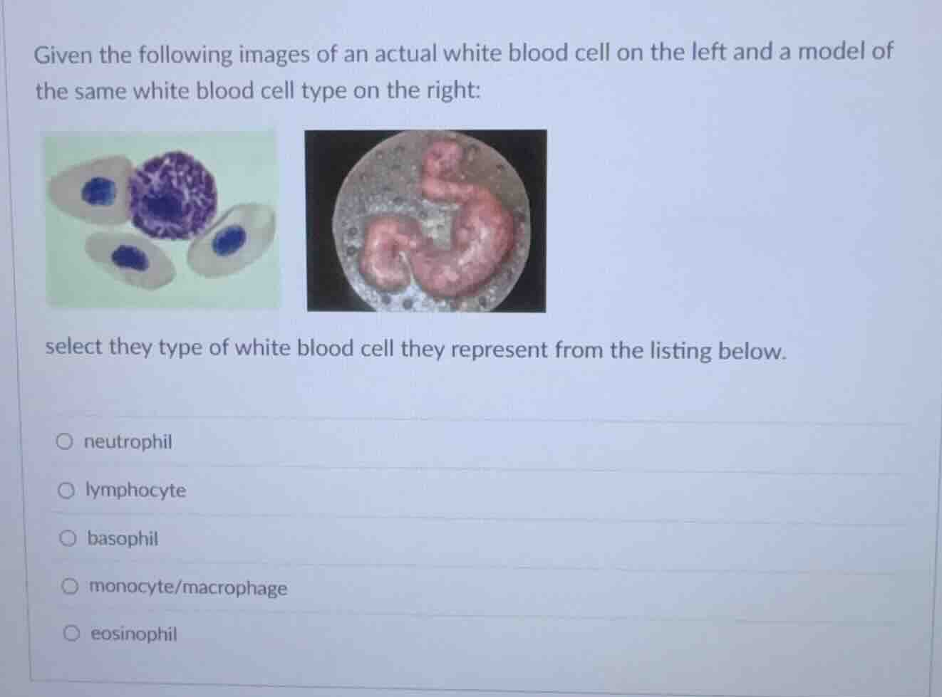 given the following images of an actual white blood cell on the left an…